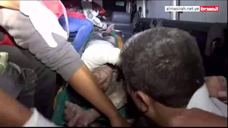 في جريمة حرب موصوفة يتستر عليها الغرب الاستعماري, الحصيلة الأولية, عشرات القتلى والمئات من الجرحى في عدوان الصهيوني بن سلمان على اليمن,