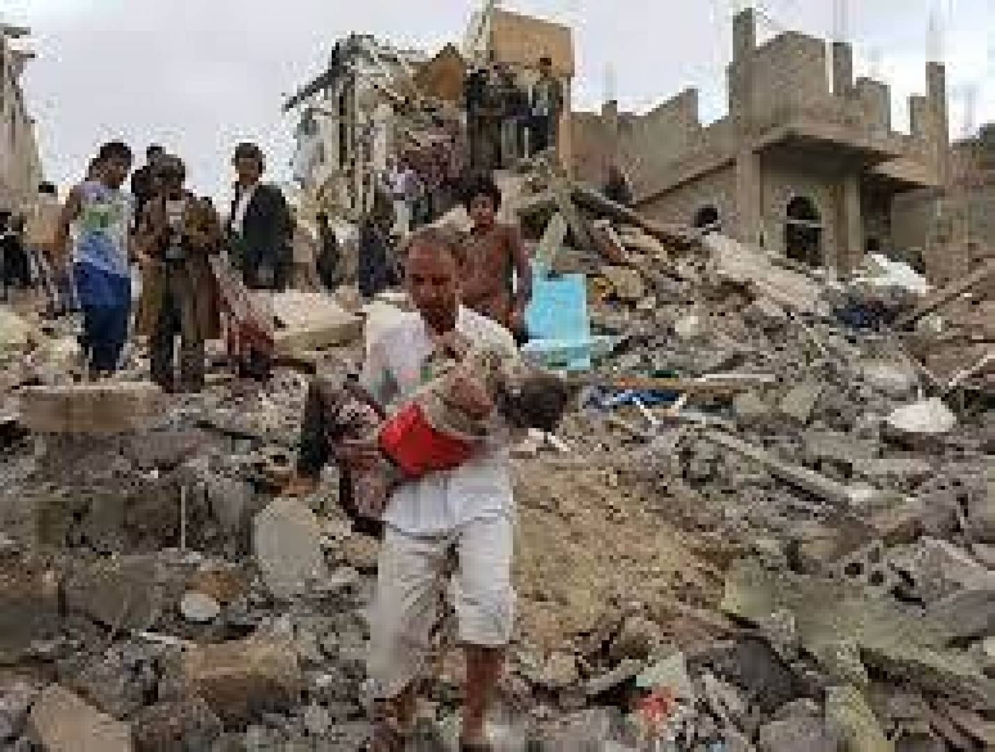 أطفال اليمن 7سنوات من القتل ولا رؤى للسلام