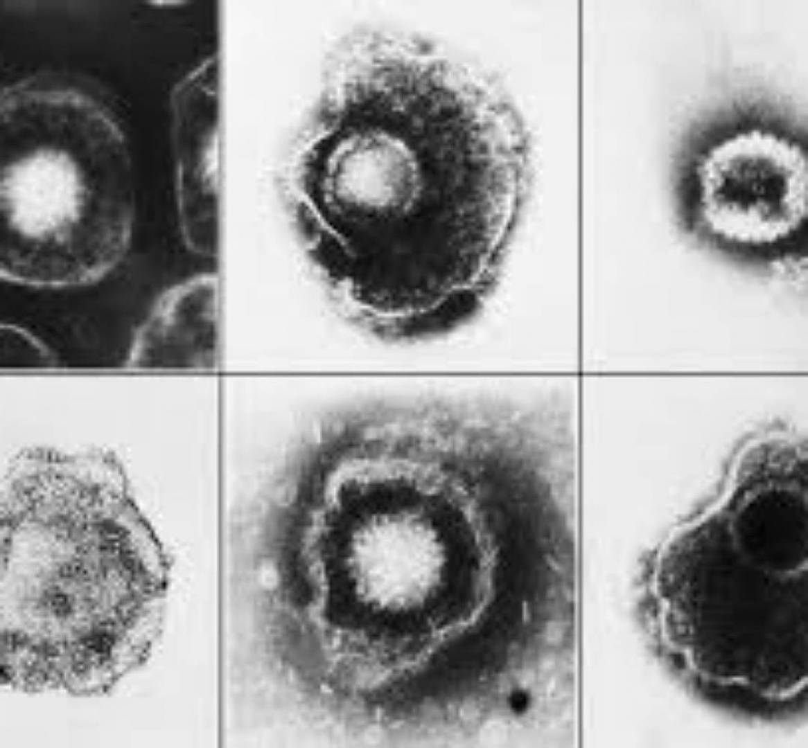 ينتشر أسرع من كورونا ...ماهو الهريس النطاقي