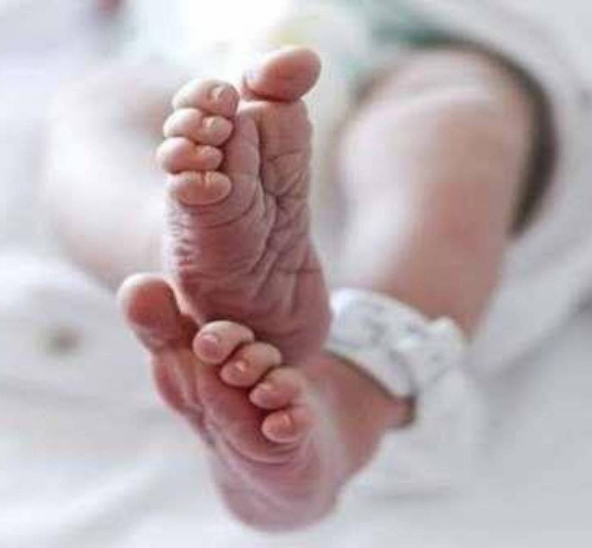 العالم شهد ست حالات مشابهة منذ قرون...ولادة طفل يمني بعين واحدة ووفاته بعد 7 ساعات