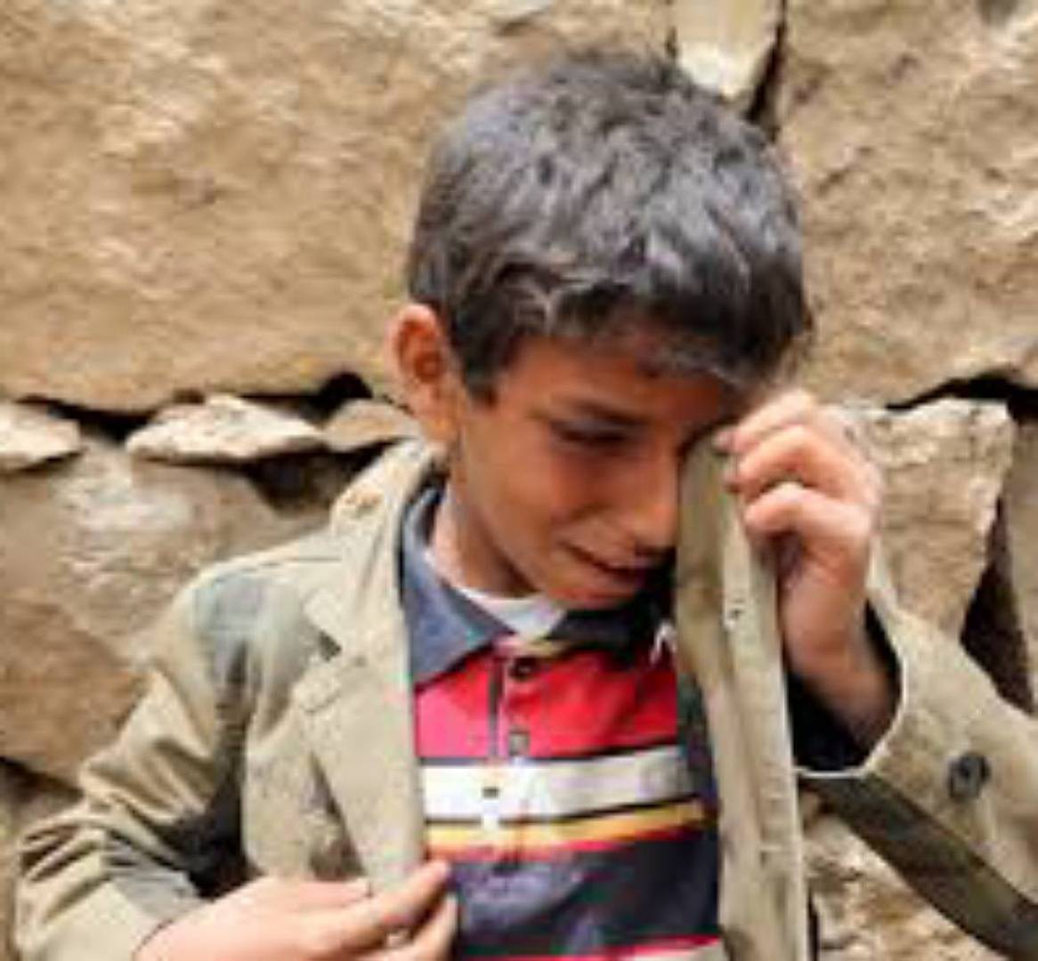 رقم مرعب...أطفال اليمن بين مرض السرطان وقصف تحالف العدوان والحصار