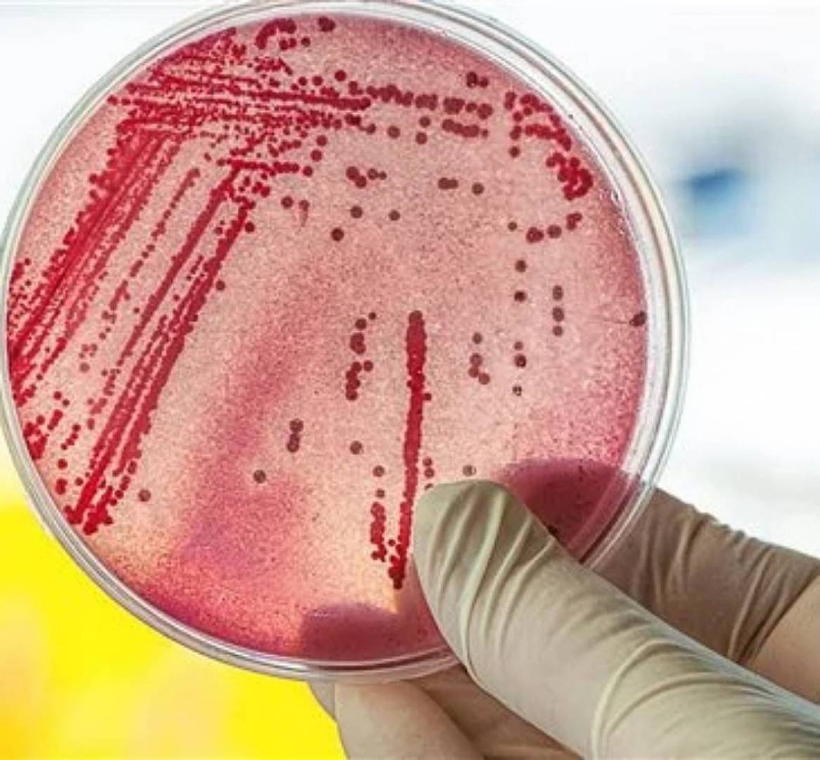 تحقيقات حول تفشي بكتيريا خطيرة في أمريكا