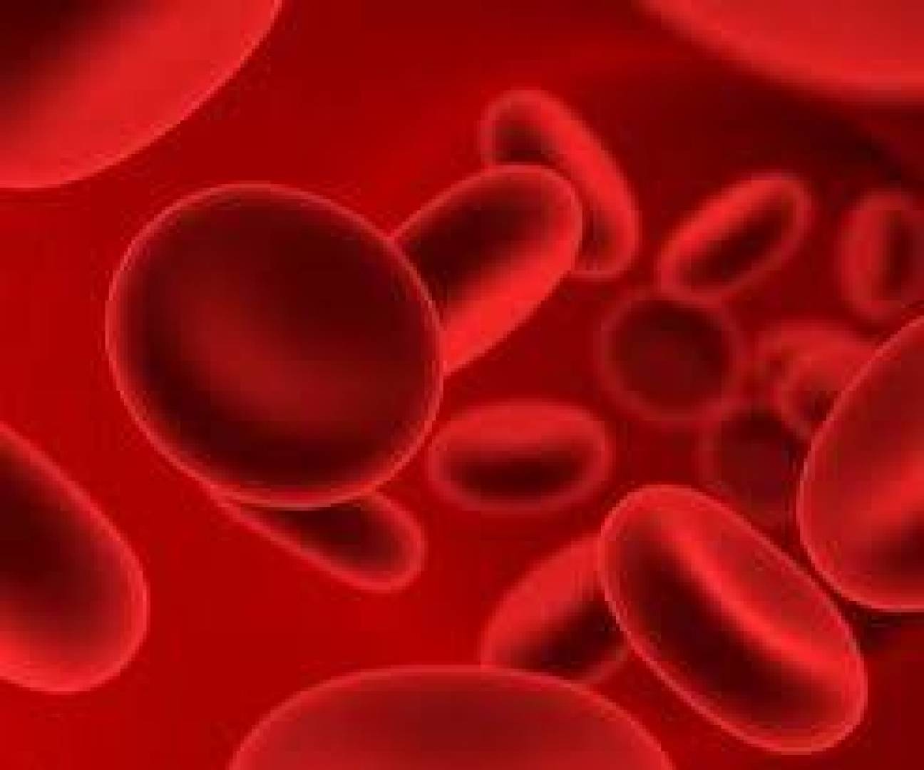 فقر الدم عند الأطفال ... أعراضه وعلاجه