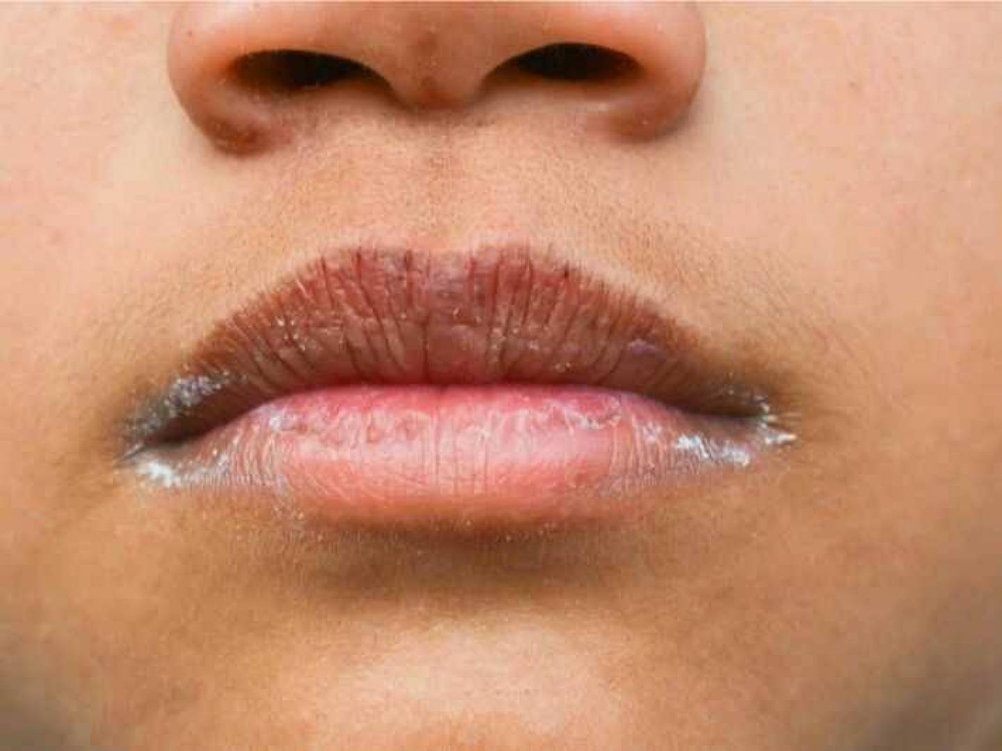 جفاف الفم قد يشير إلى أمراض خطيرة .. تعرف عليها