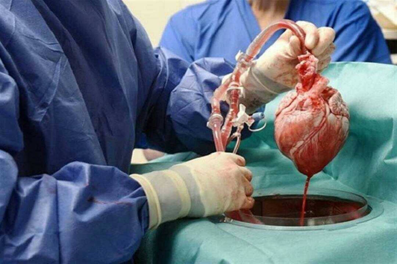كل شيئ عن عملية زرع القلب
