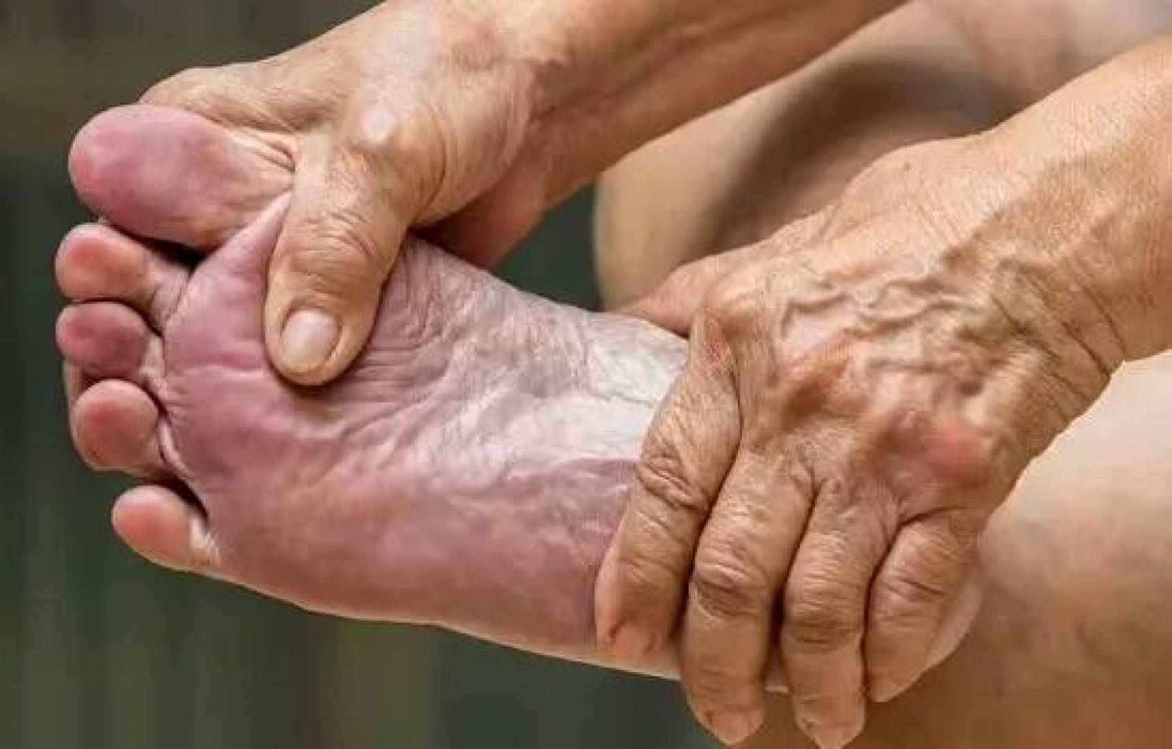 الطفح الجلدي المتنقل والتهاب الوريد الخثاري السطحي