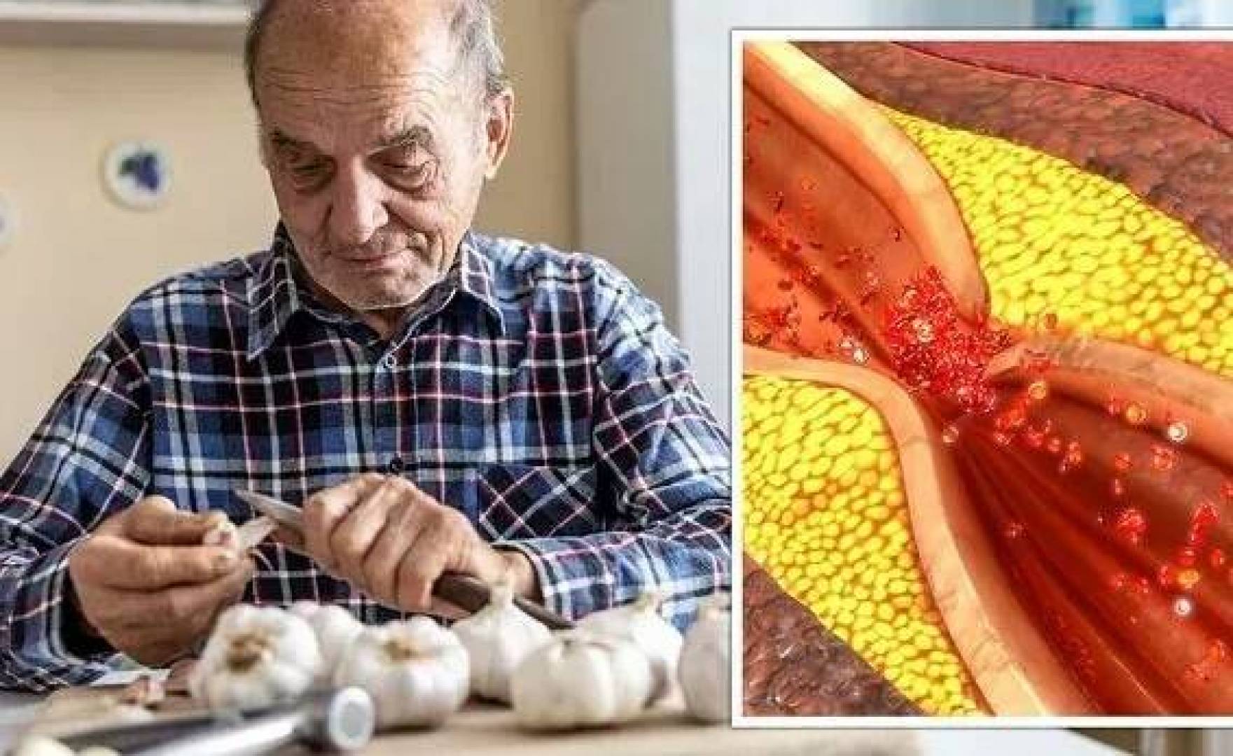 تناول الثوم يساعد على خفض نسبة الكوليسترول الضار