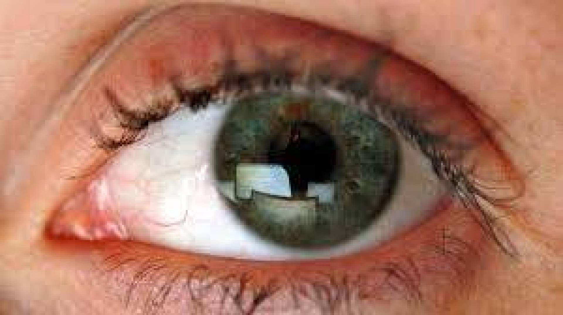 احذر التوتر .. يسبب فقدان البصر