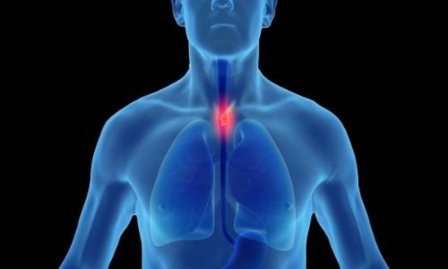 علامات تشير إلى الإصابة بسرطان المريء عند تناول الطعام