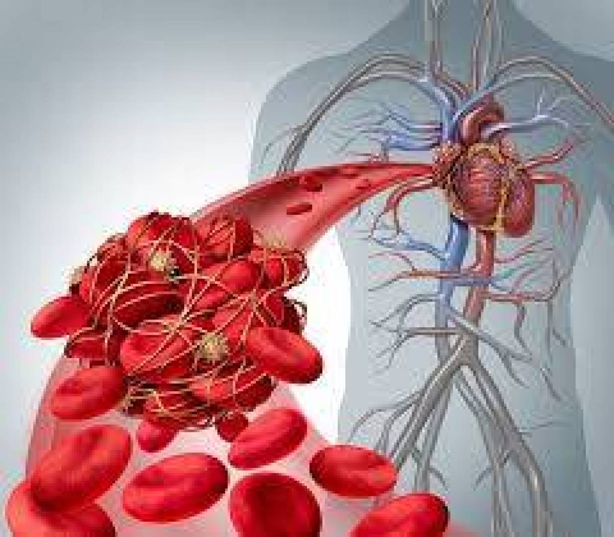 أنواع الاختبارات الطبية التي تكشف عن الجلطات الدموية