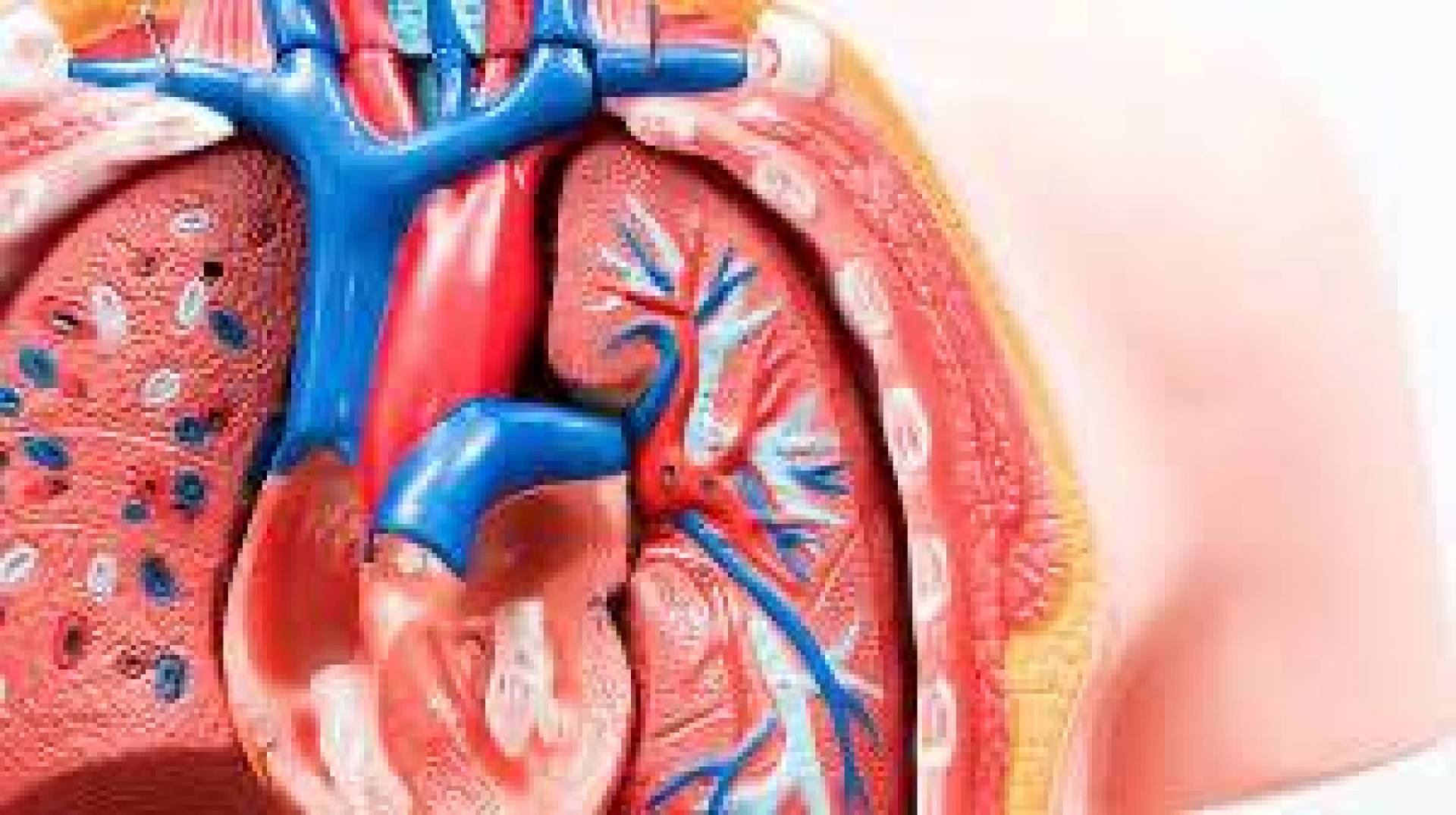 أطباء روس يزرعون أول صمام حيوي للأبهر بعملية قسطرة