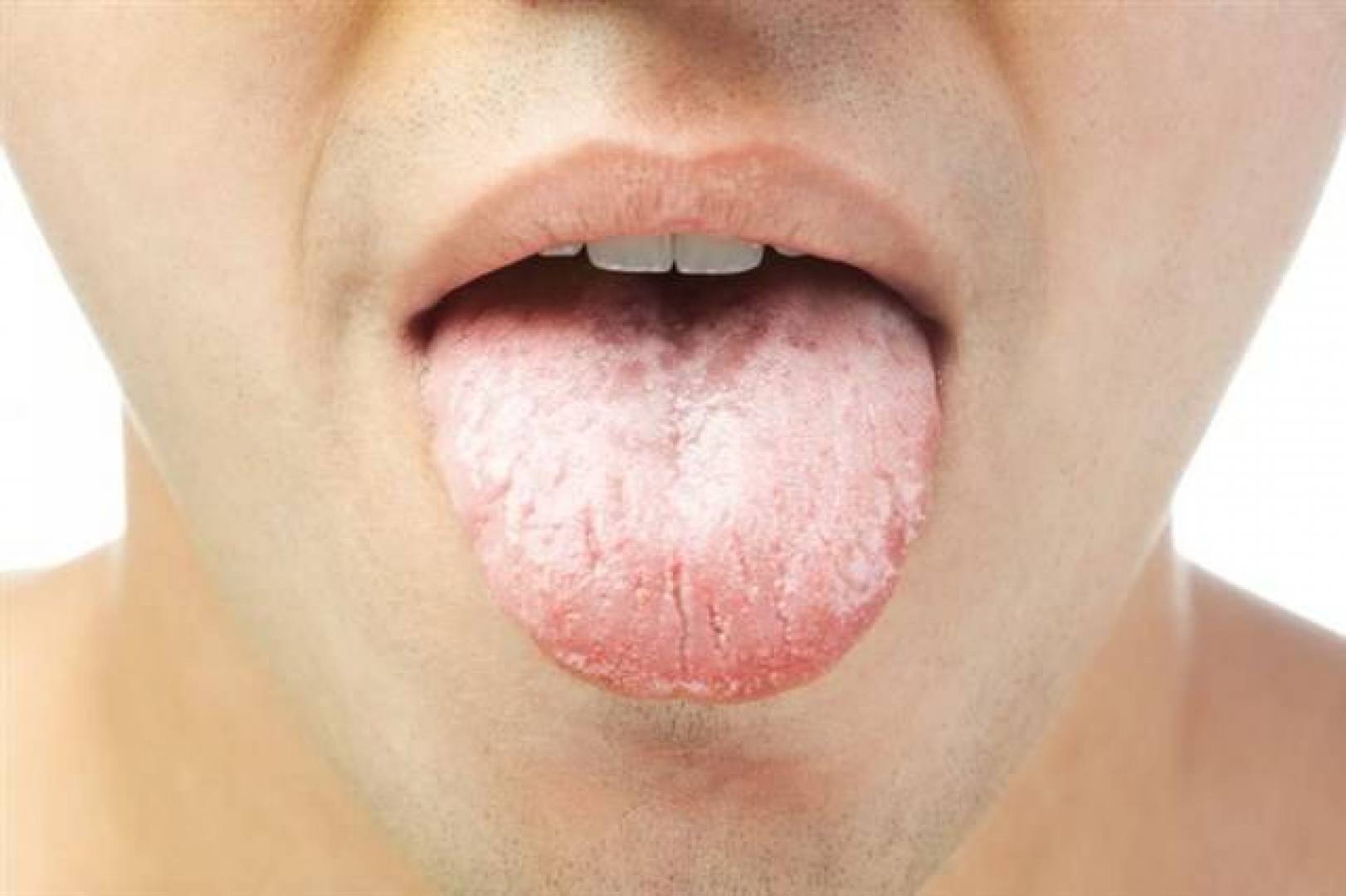 جفاف الفم قد يكون علامة إنذار لمجموعة من الأمراض الخطيرة