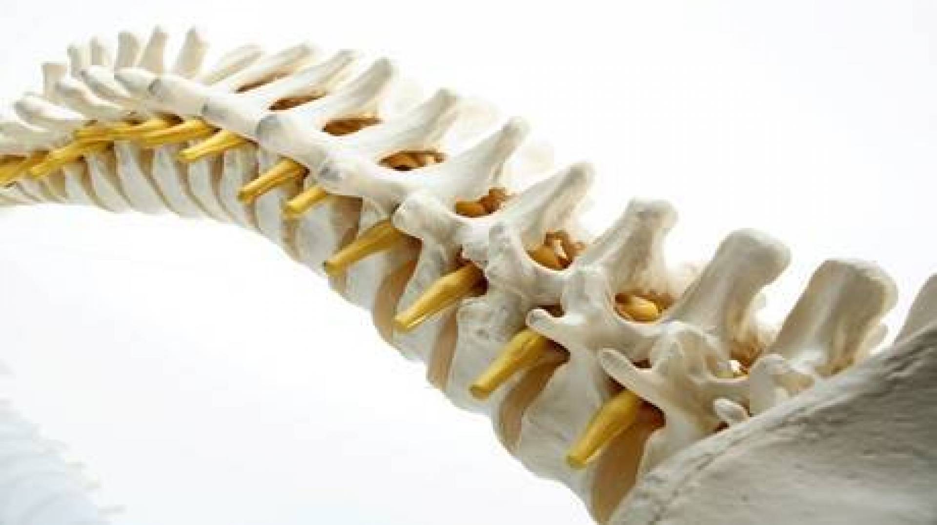 ابتكار غرسات معدنية لعلاج الفقرات القطنية من العمود الفقري