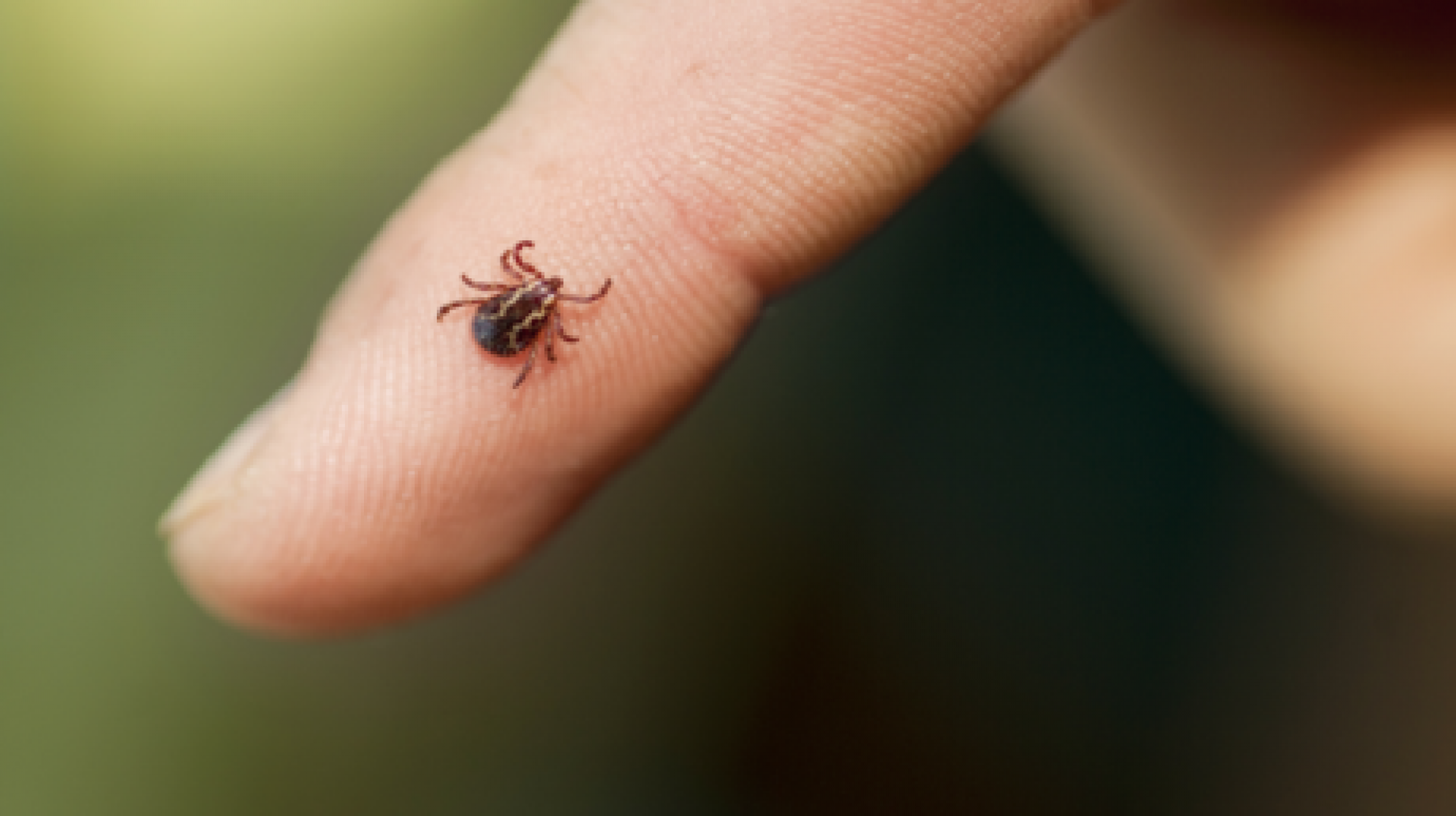 ماهو فيروس التهاب الدماغ المنقول بالقراد (TBEV) والمكتشف حديثا في بريطانيا