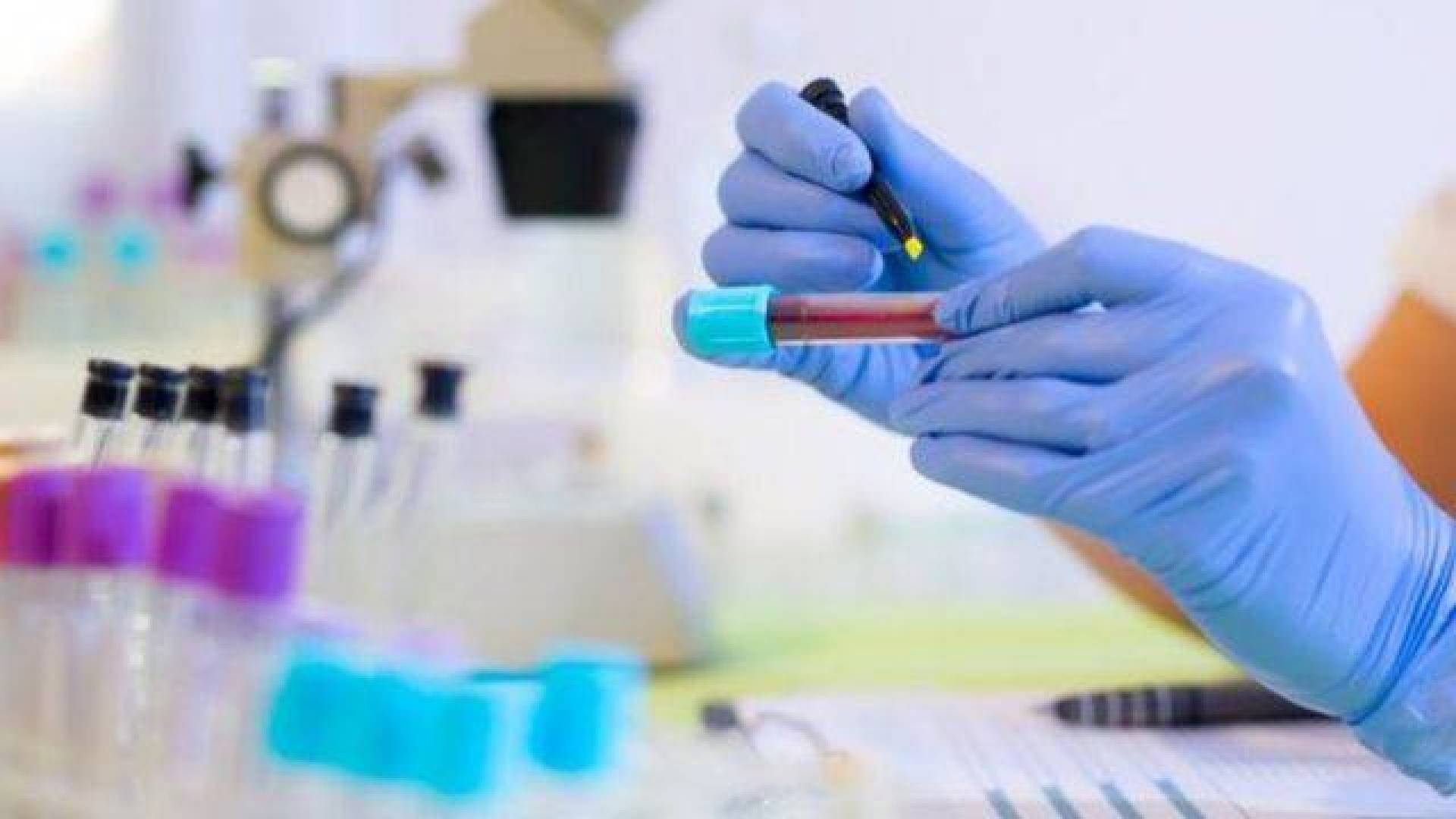 اختبار دم يكشف احتمال إصابتك بمرض السكري خلال عشر سنوات قادمة