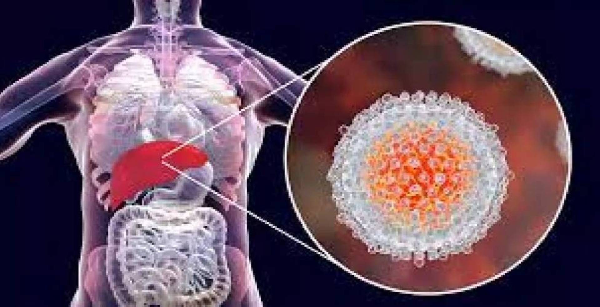 القناع الخبيث: باحثون يحلون لغز تمويه فيروس التهاب الكبد الوبائي C