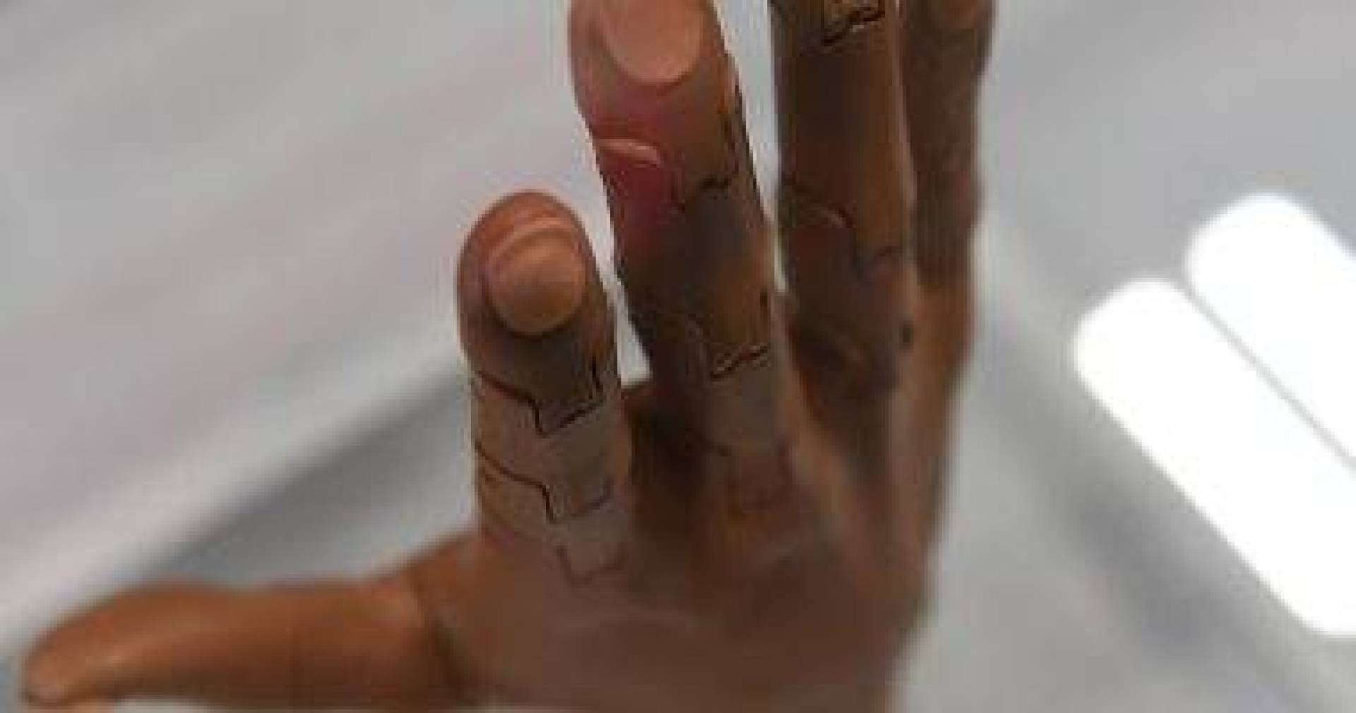 تقنية المبرد الكهروحراري القابل للارتداء: ابتكار جديد يساعد مبتوري الأطراف على الشعور بالحرارة