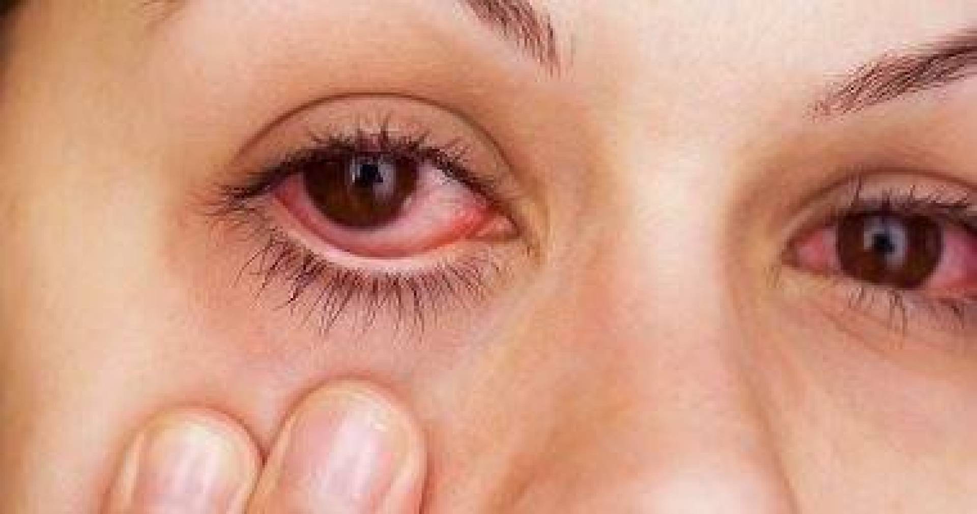 علامات في العين تشير إلى مشاكل صحية خطيرة
