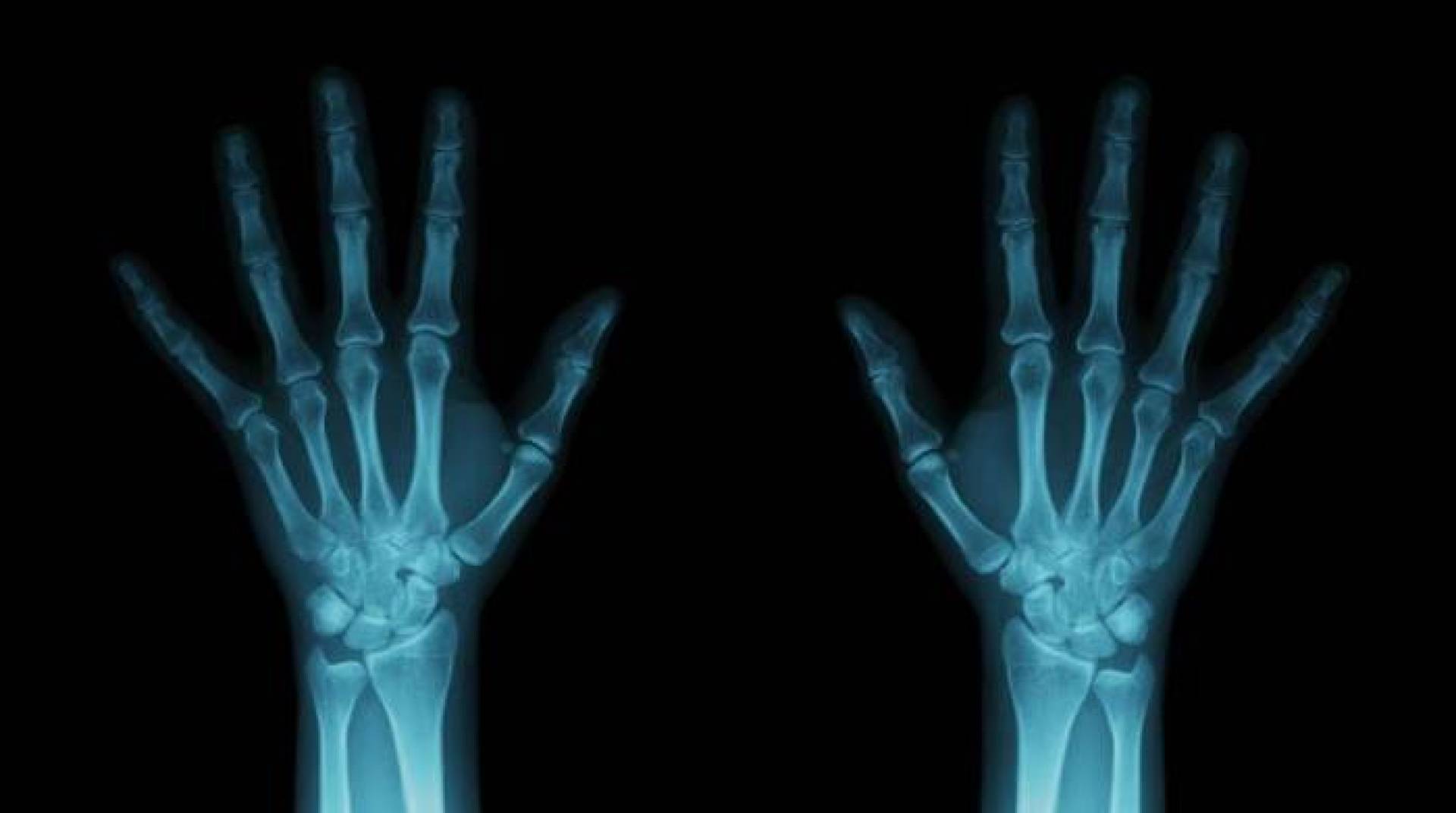 هل يؤثر التصوير بالأشعة السينية على جسم الإنسان ؟