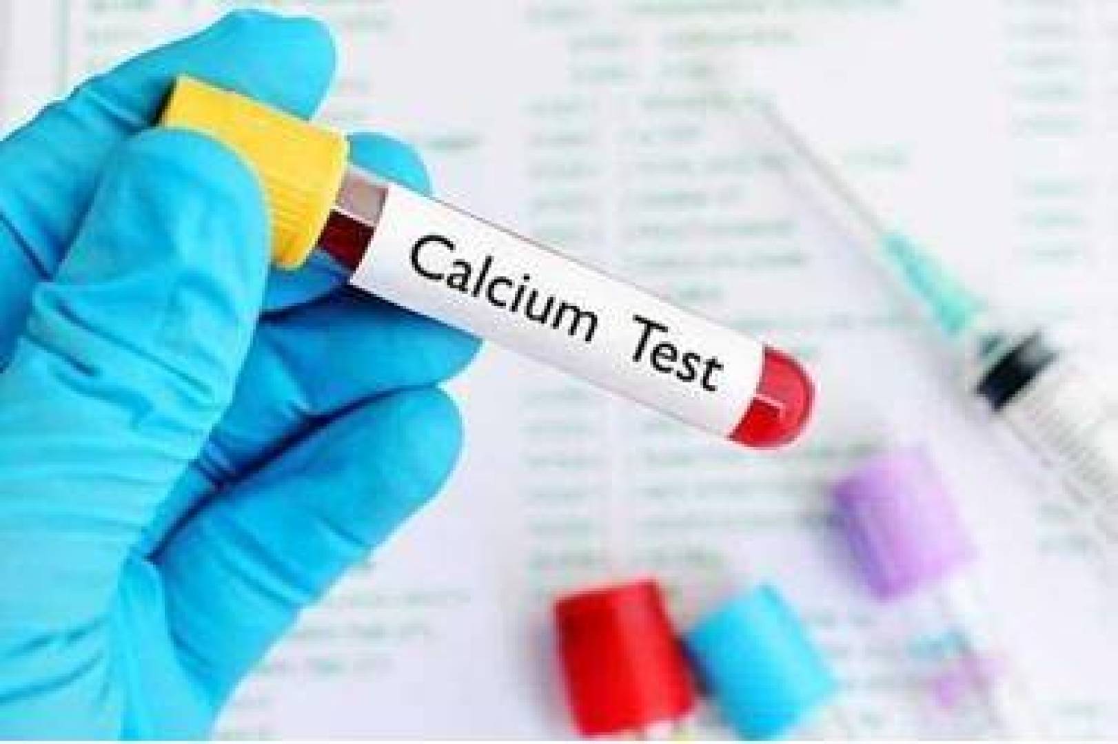 انخفاض مستويات الكالسيوم في الدم .. الأسباب والأعراض وطرق العلاج