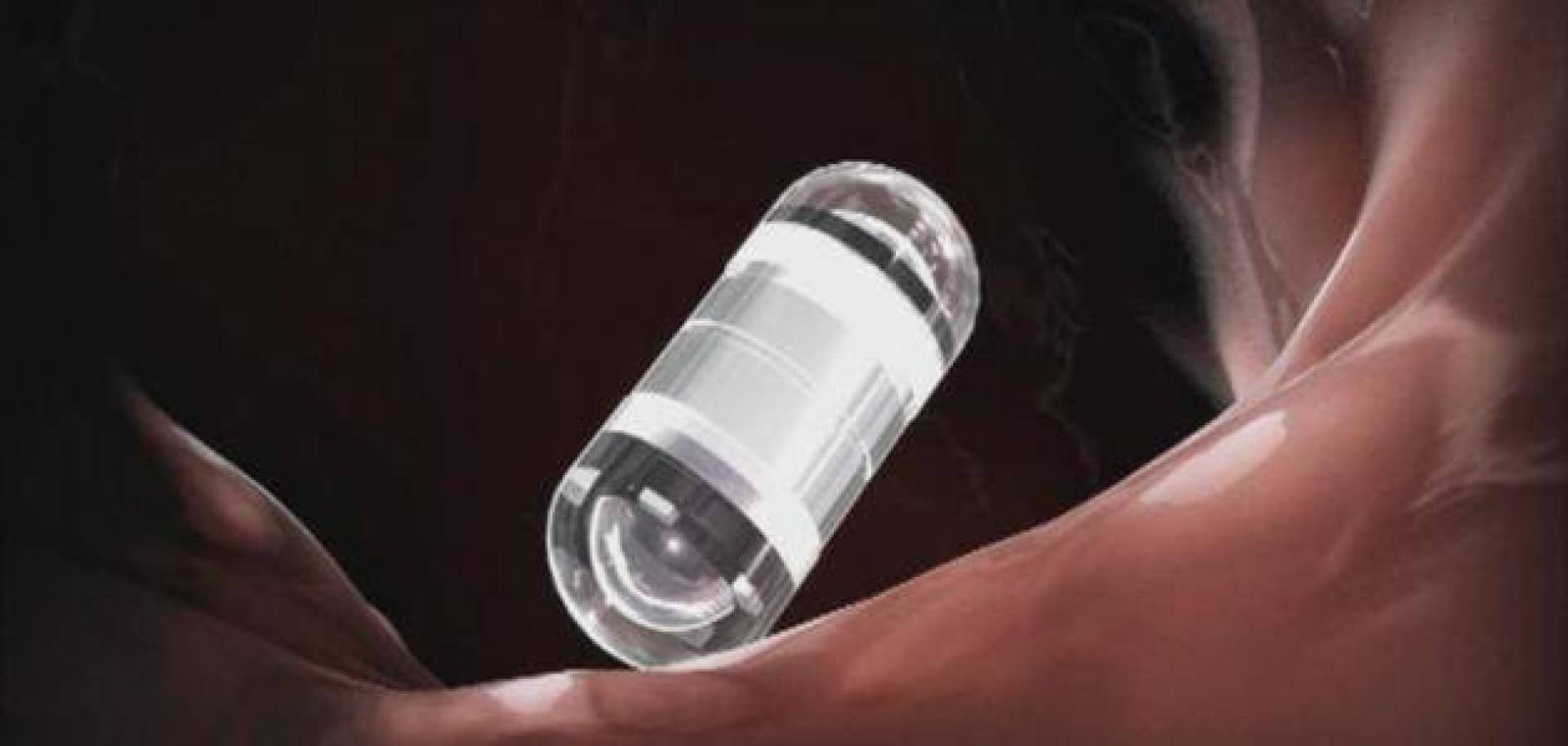 ابتكار كبسولة ذكية لمراقبة وعلاج أمراض الأمعاء