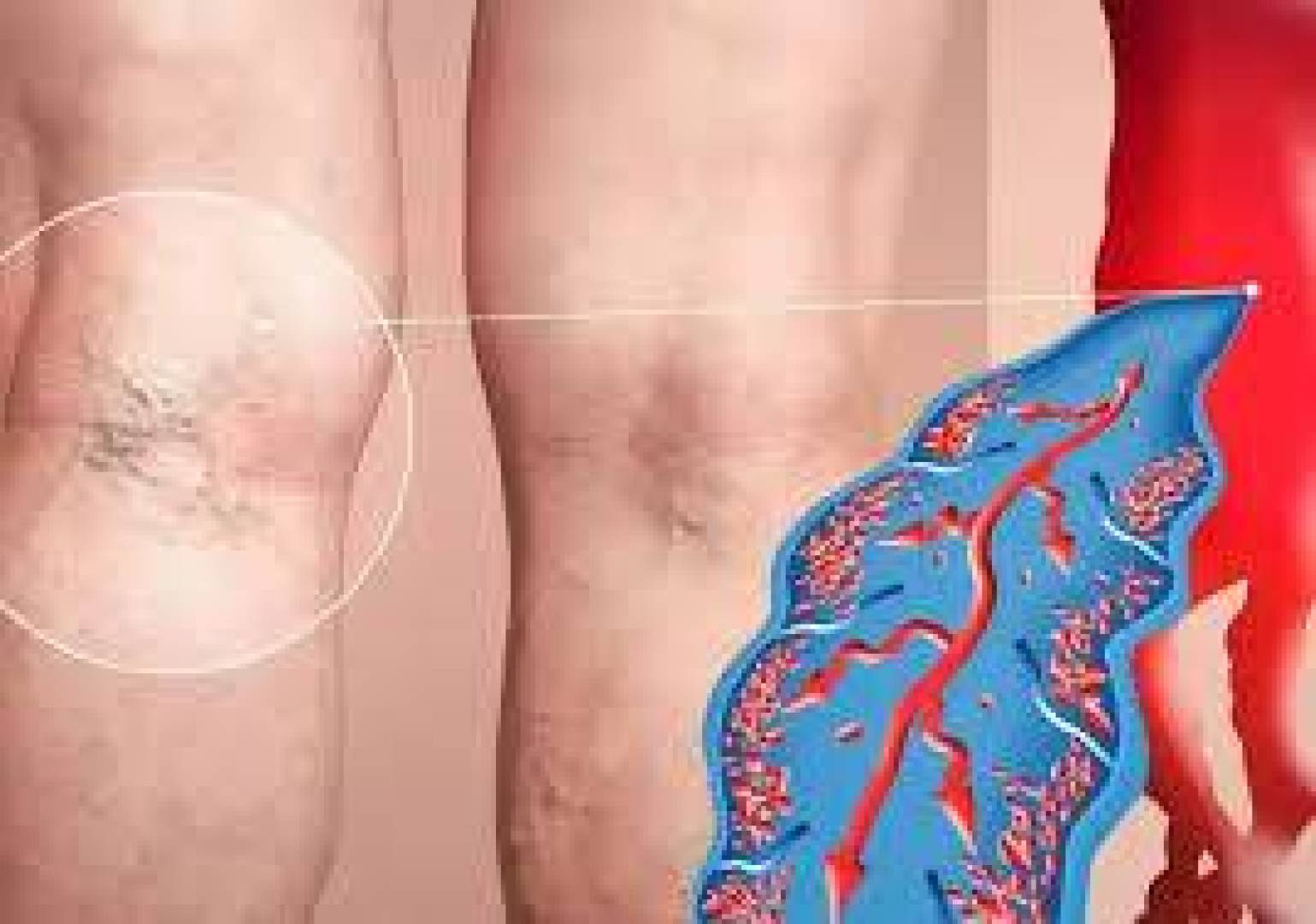 كيف تحمي قدميك من تجلط الدم: ثلاث نصائح هامة