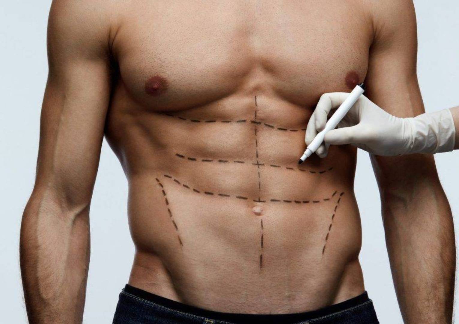 دكتور التجميل يوسيل ساريالتين يستعرض نتائج عملية الستة حزم six pack surgery