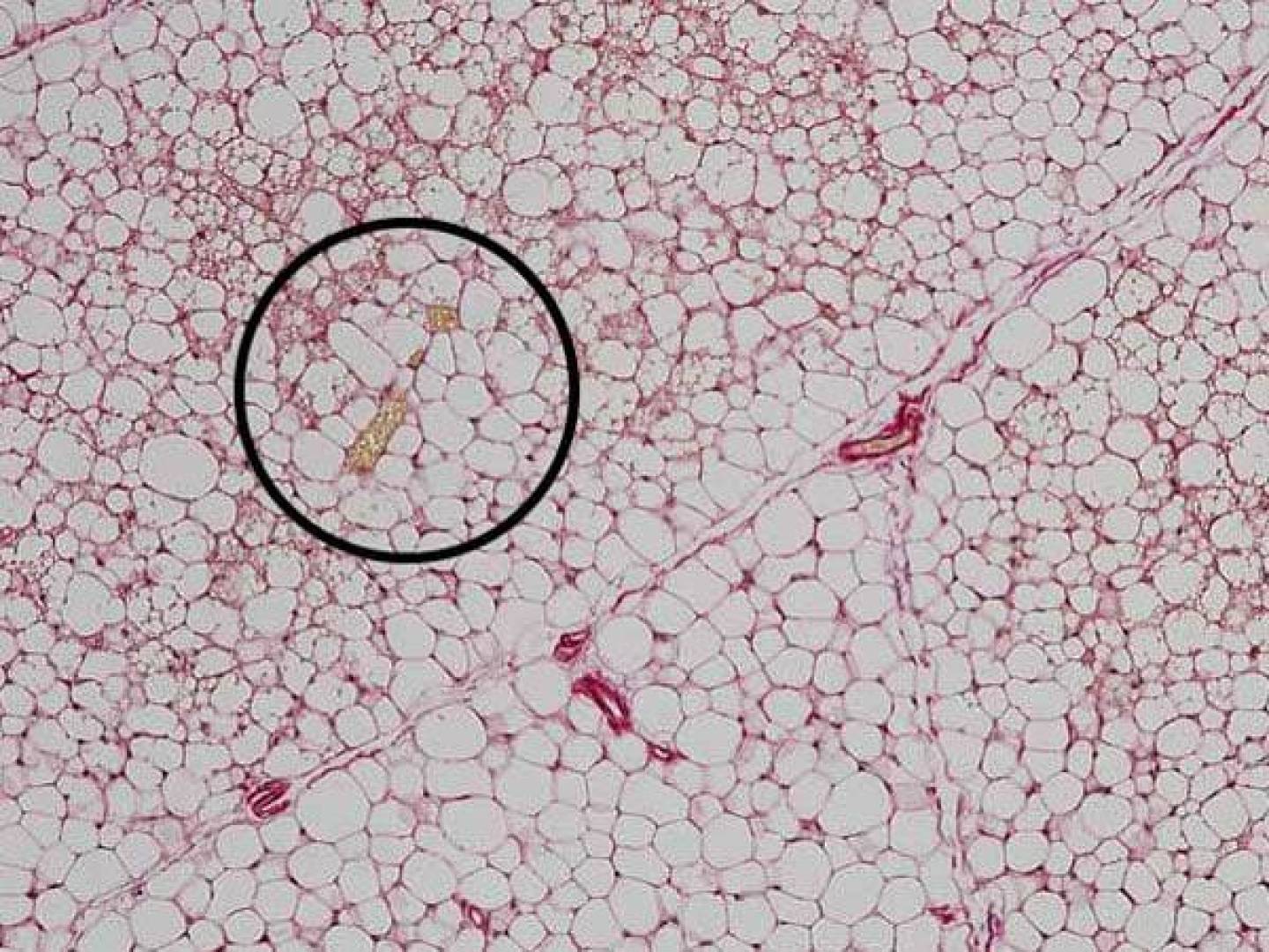 طريقة جديدة لحرق السعرات الحرارية بواسطة الخلايا الدهنية العادية