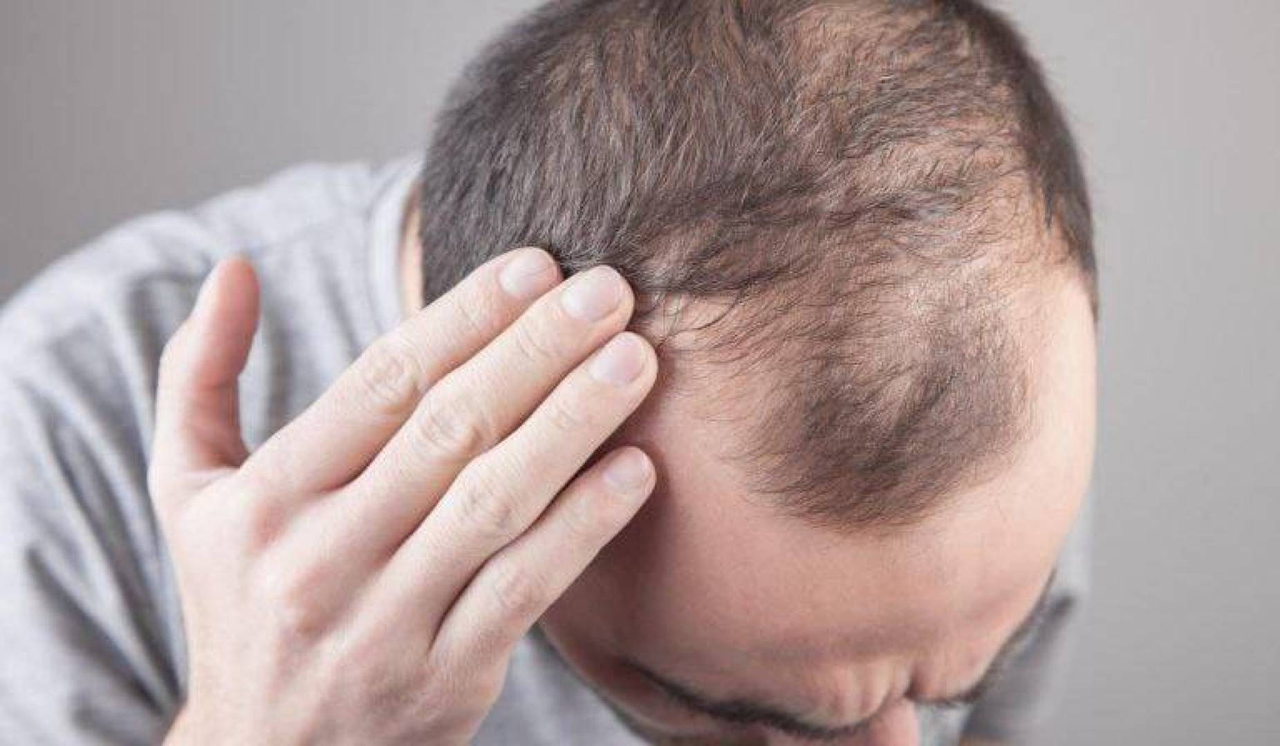 تفعيل مفتاح جزيئي قد يكون الحل النهائي لتساقط الشعر