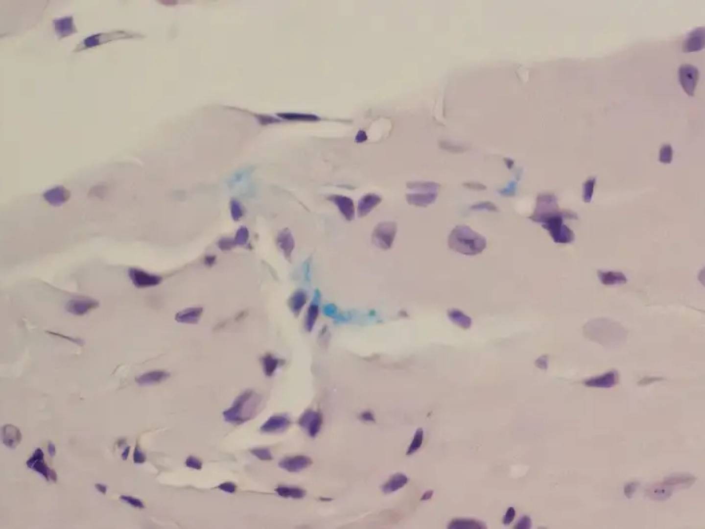 بكتيريا اللثة تتسلل إلى القلب وتفجر اضطرابا قاتلا في النبض