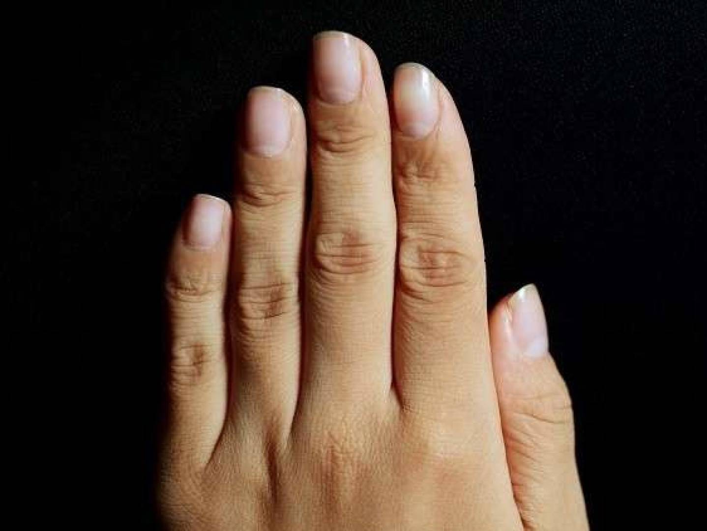 تطبيق يعمل بالذكاء الاصطناعي يكشف فقر الدم