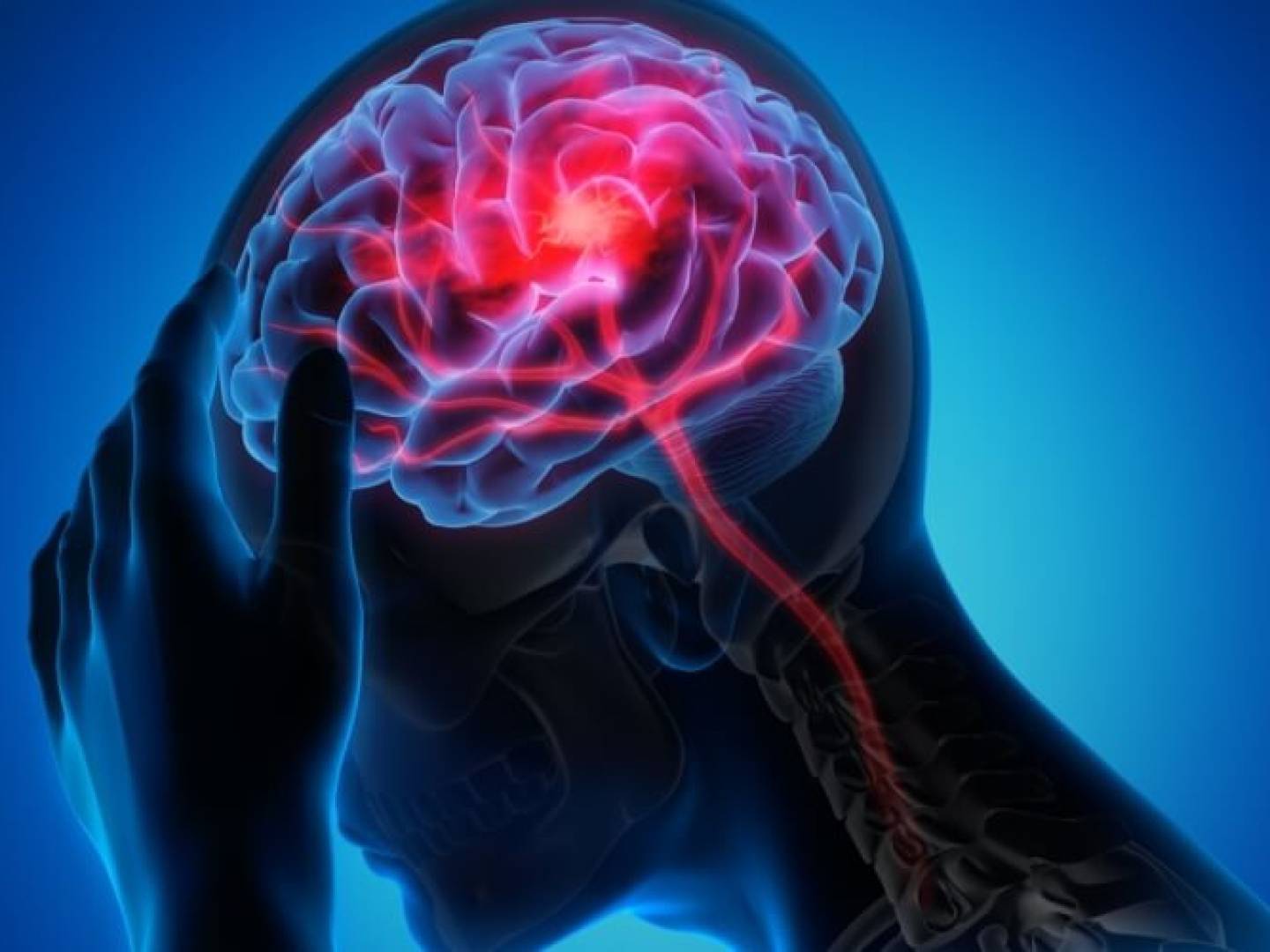 فقر الدم الناتج عن نقص الحديد يزيد خطر الإصابة بالسكتة الدماغية