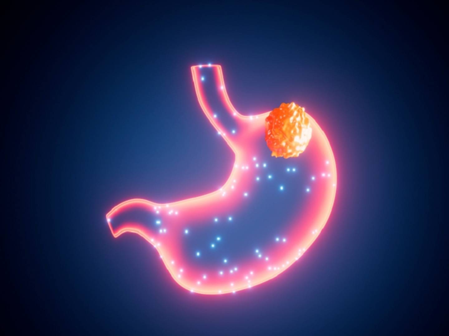 شركة علي بابا تطلق أول نموذج ذكاء اصطناعي عالمي لاكتشاف سرطان المعدة المبكر شركة علي بابا تطلق أول نموذج ذكاء اصطناعي عالمي لاكتشاف سرطان المعدة المبكر