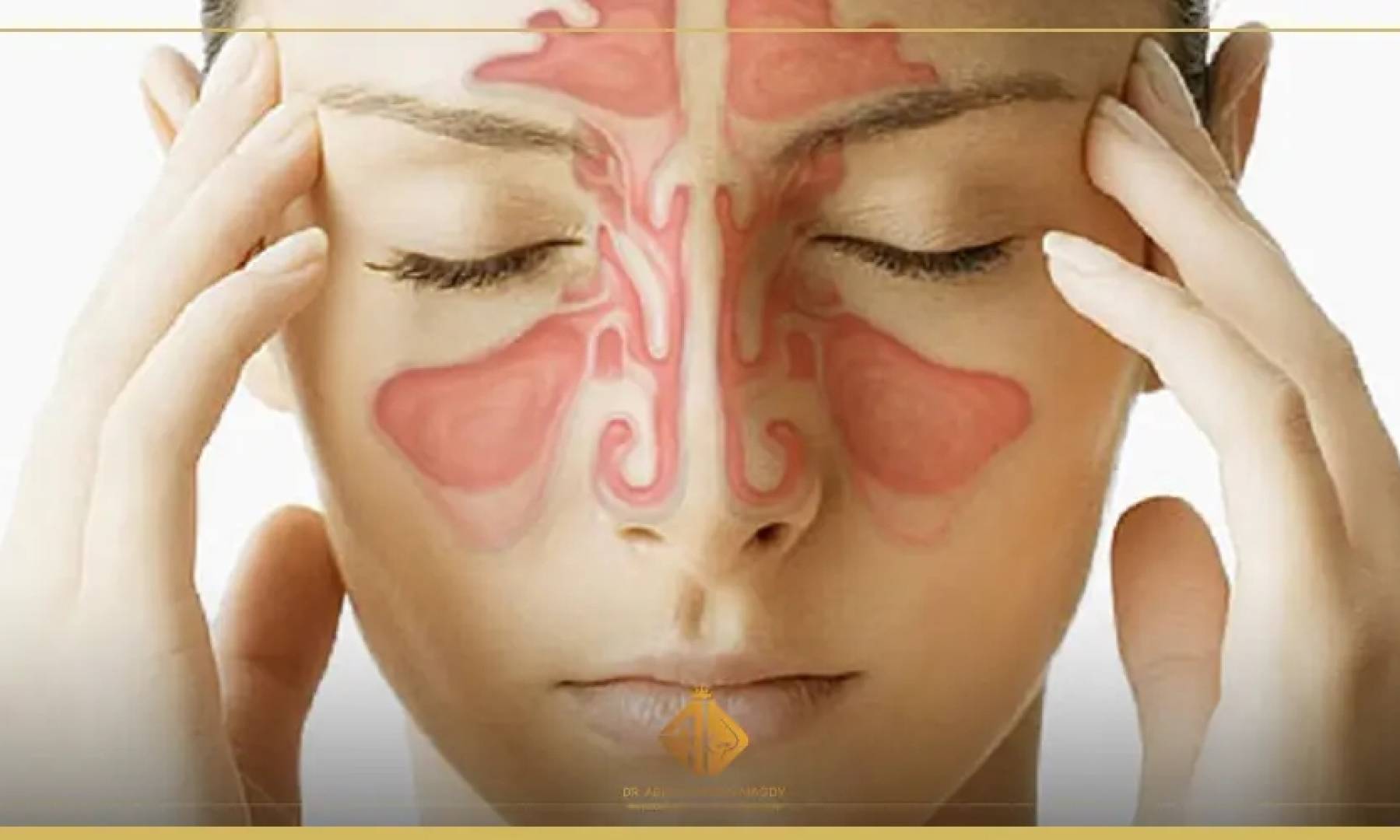 أسباب وأعراض التهاب الجيوب الأنفية.. التشخيص والعلاج الطبي الشامل أسباب وأعراض التهاب الجيوب الأنفية.. التشخيص والعلاج الطبي الشامل