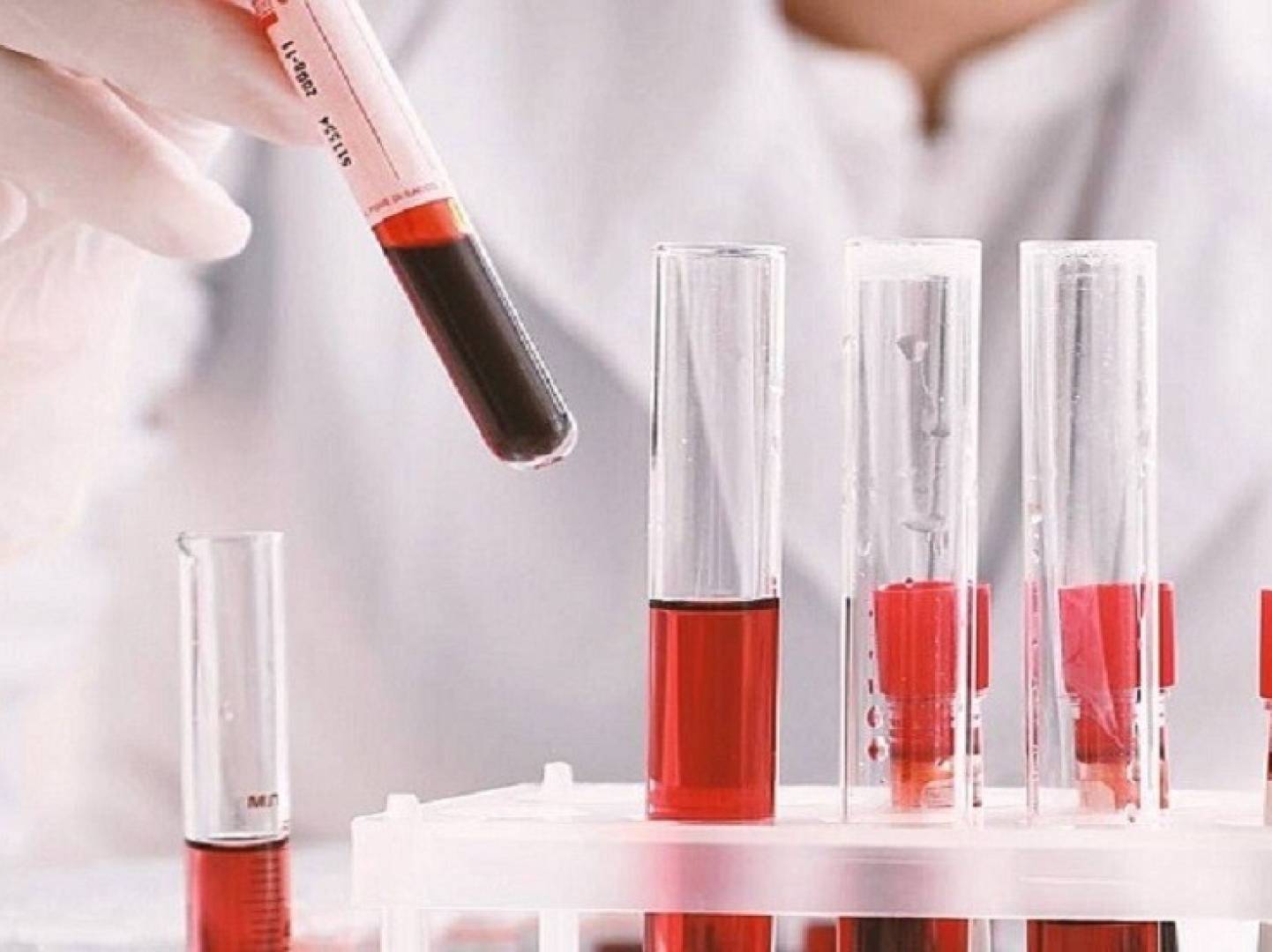 ابتكار روسي جديد شريحة تكشف تحاليل الدم خلال دقائق فقط