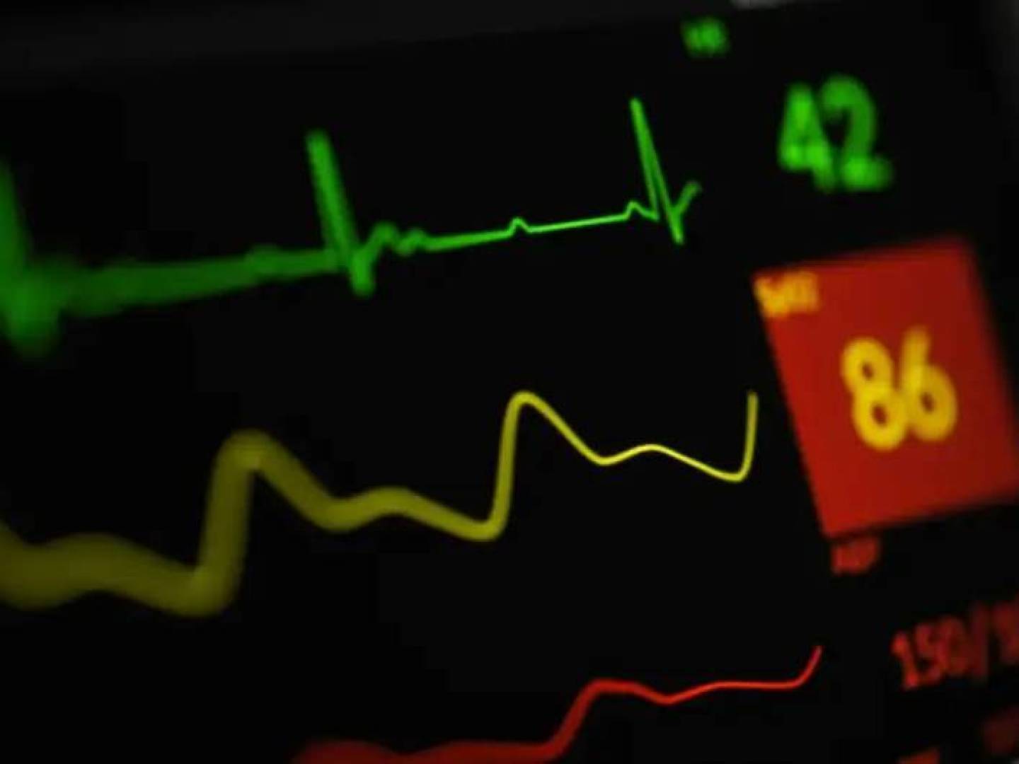 بروتين مناعي يسبب اضطراب ضربات القلب القاتل بعد النوبة القلبية