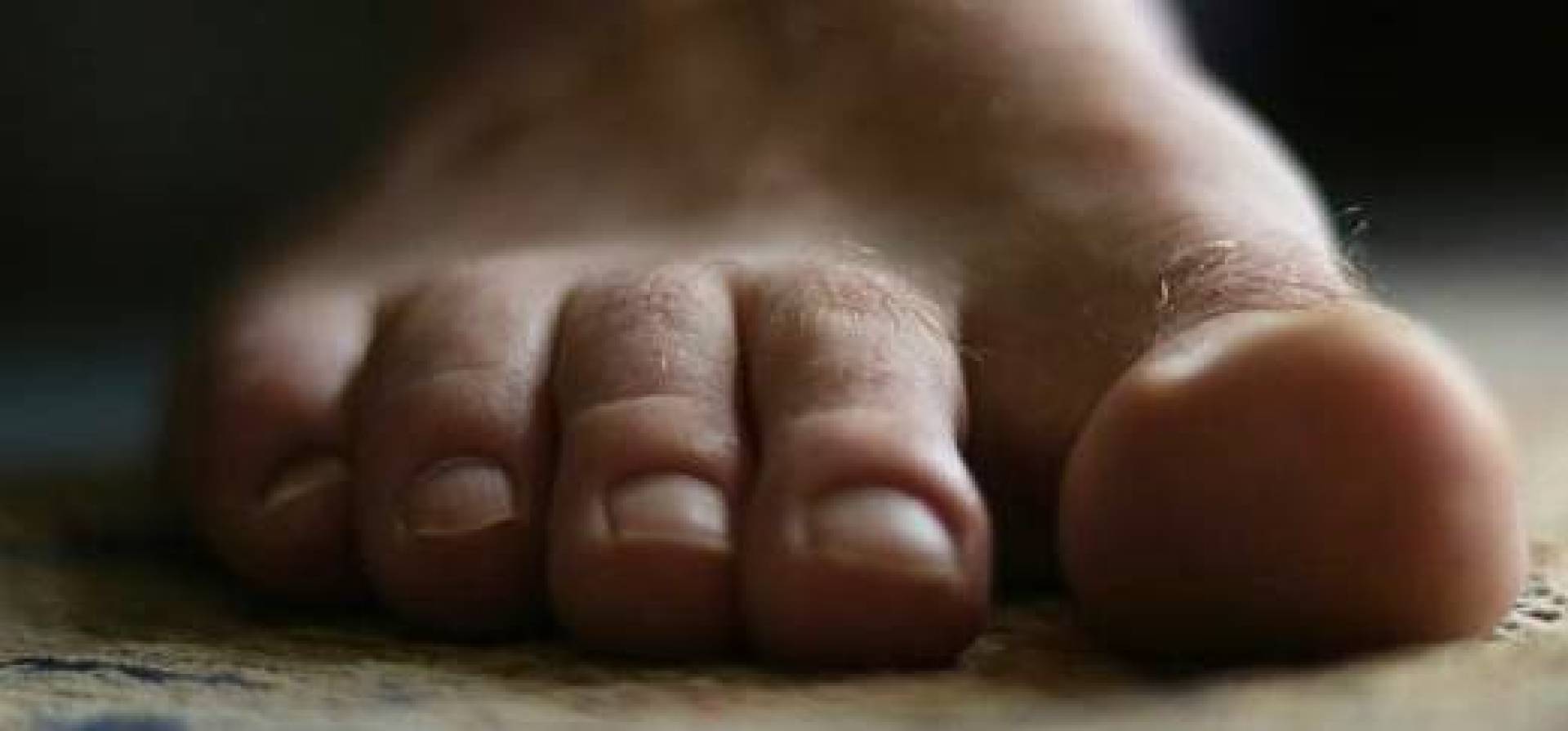تأثير الميكروبات بين أصابع القدمين والجوارب على الصحة