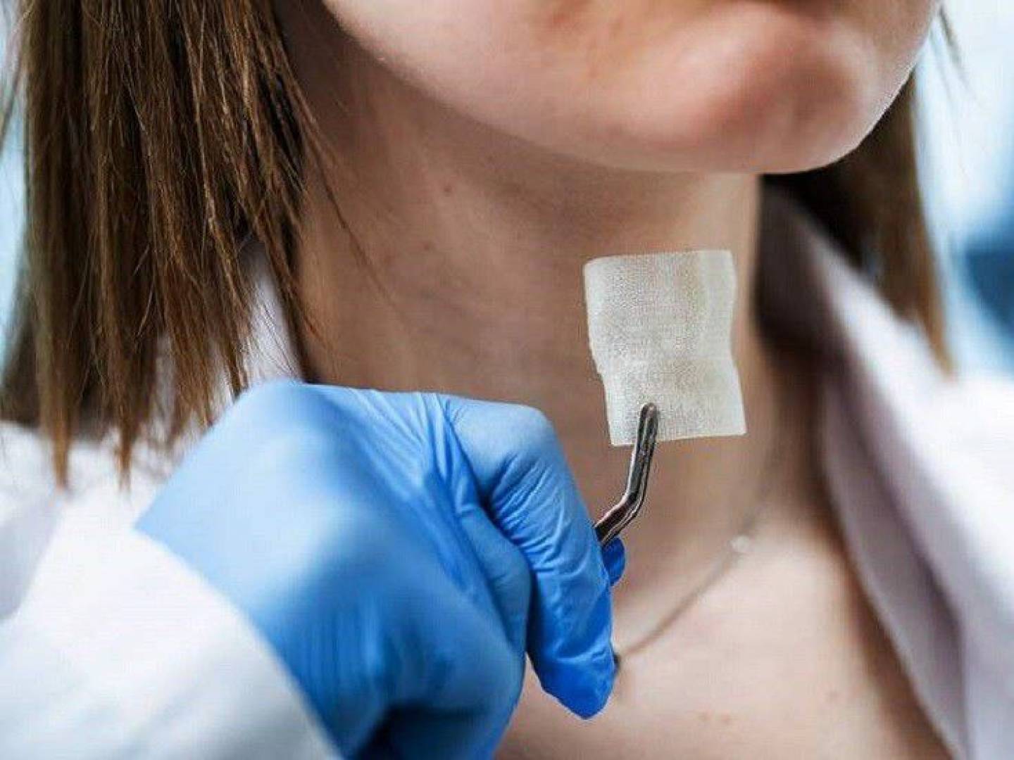 طباعة غضروف حنجري ثلاثي الأبعاد يعيد الأمل لمرضى سرطان