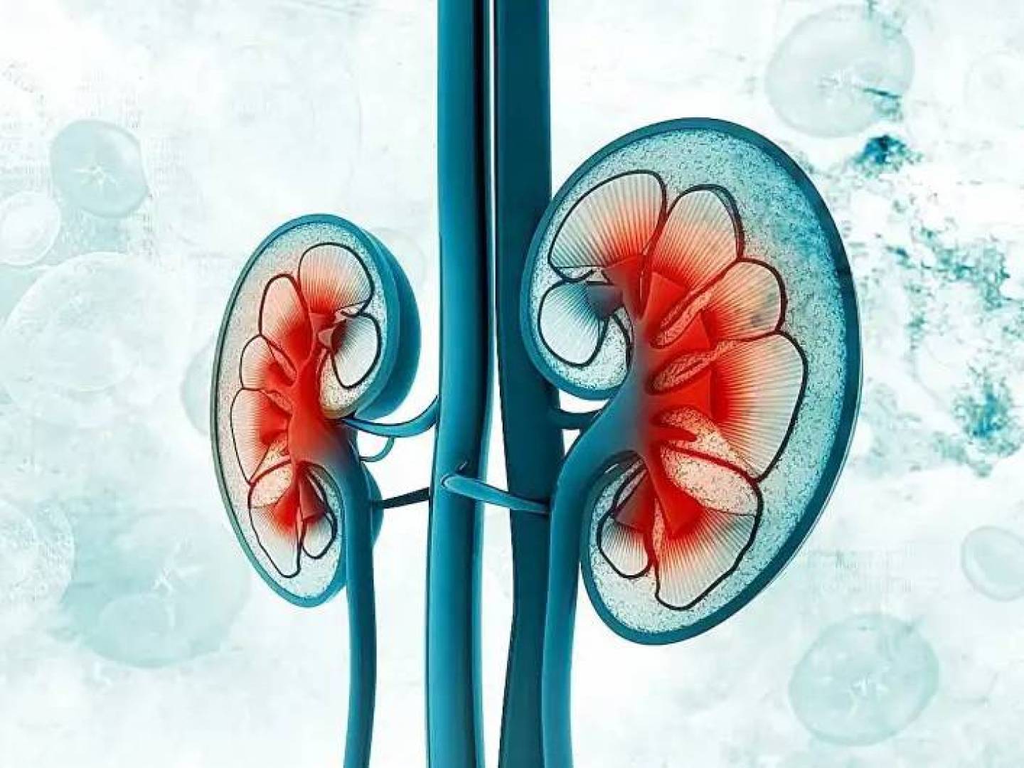 الربط بين ارتفاع مؤشر شدة متلازمة الأيض وزيادة خطر الإصابة بمرض الكلى المزمن