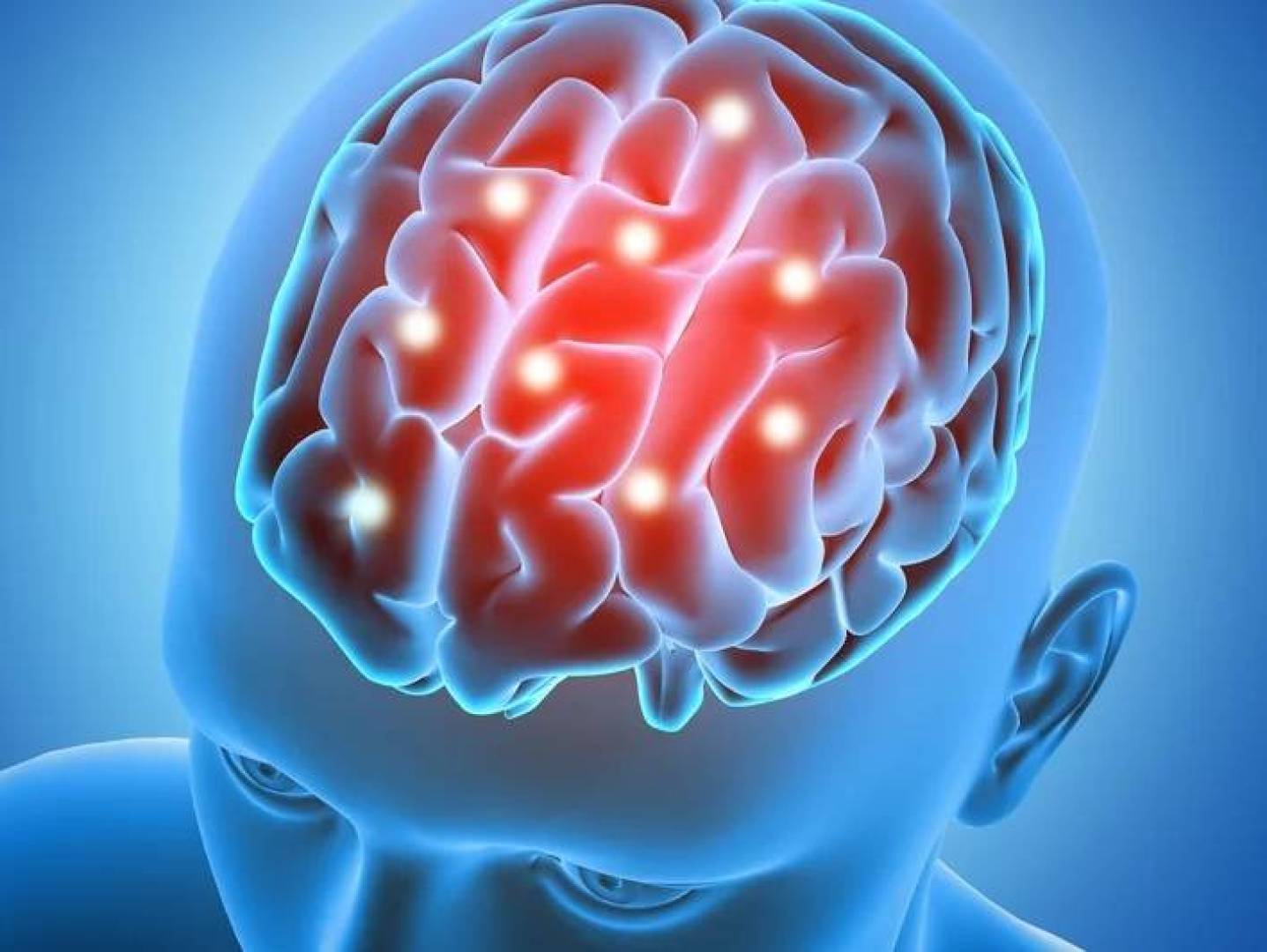 زرع خلايا جذعية عصبية لإعادة نمو خلايا الدماغ بعد السكتة الدماغية