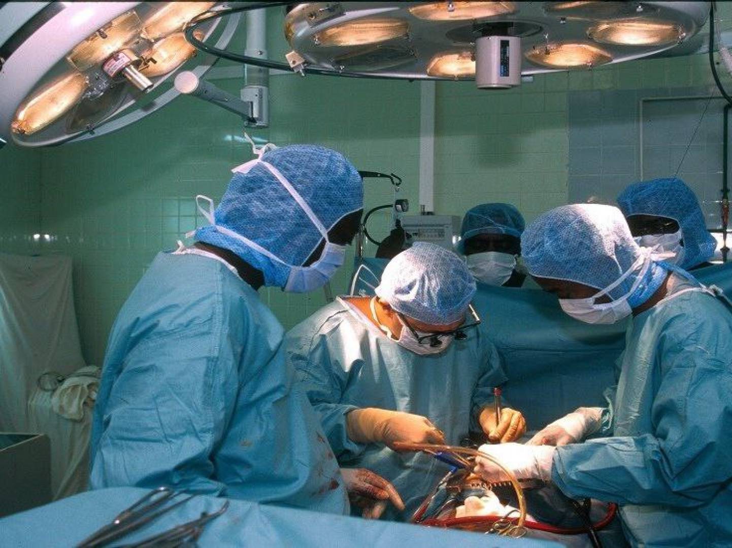 زراعة القلب دون إيقافه أو تبريده تفتح آفاقا جديدة في جراحة الأعضاء