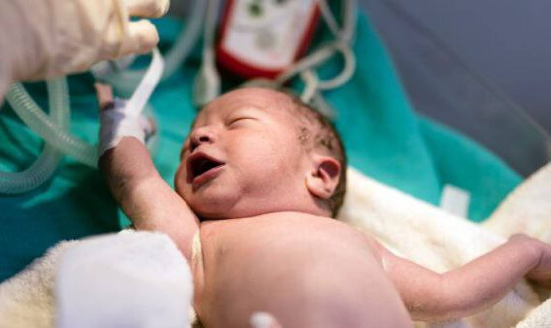 اكتشاف نوع جديد ونادر من مرض السكري يصيب حديثي الولادة فقط