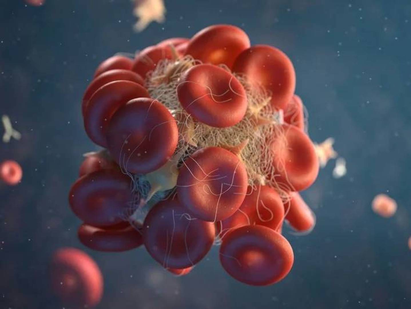 ابتكار جزيئات نانوية من الميلانين تمنع تكوّن الجلطات الدموية