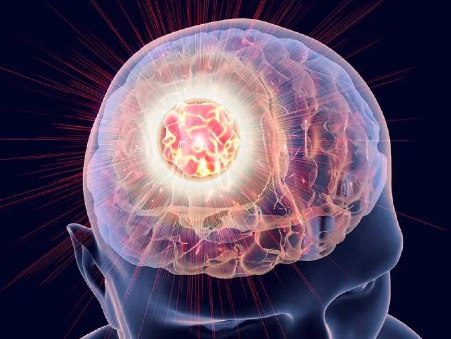 الموجات فوق الصوتية تفتح آفاقا جديدة لعلاج الأورام