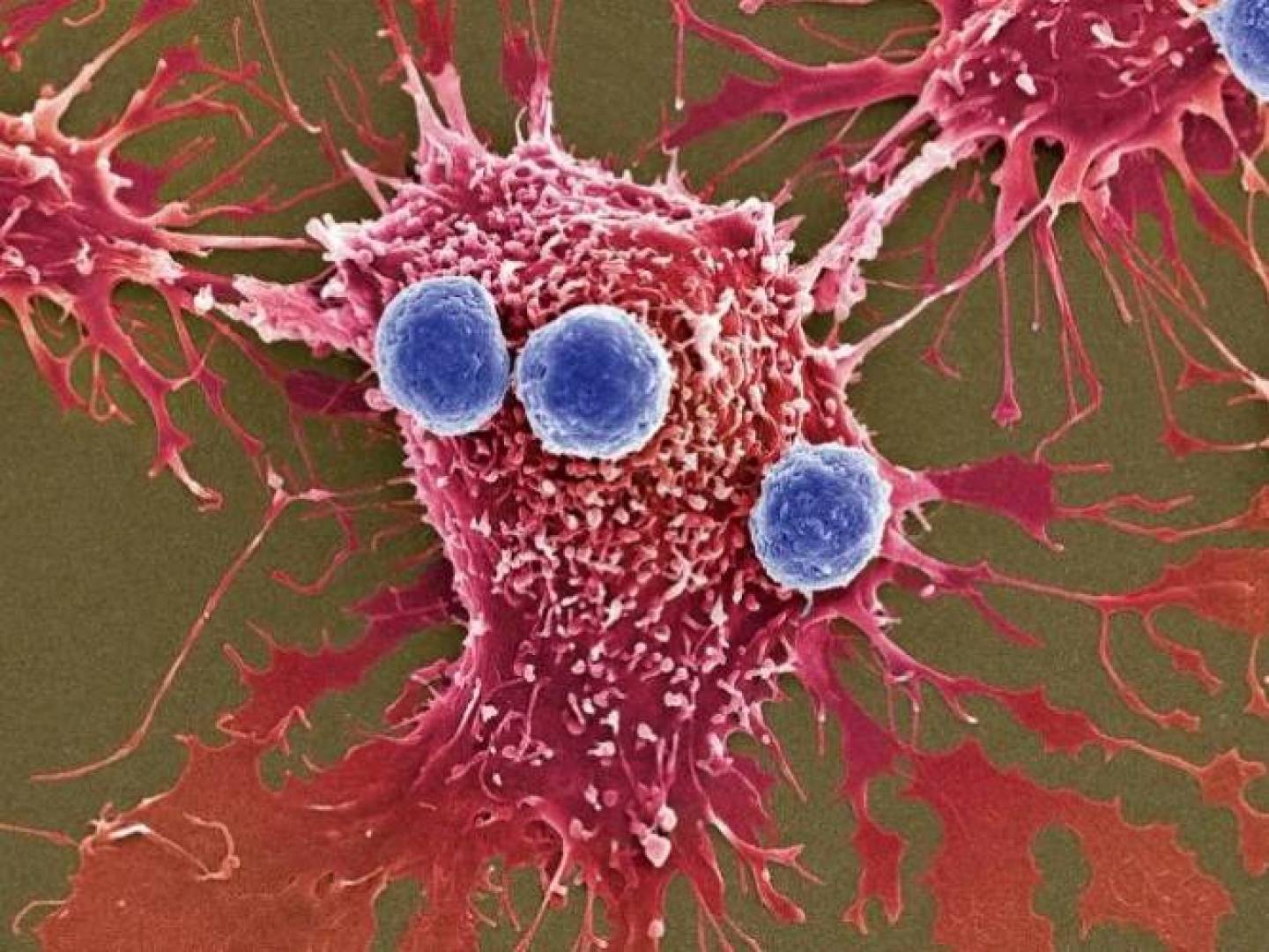 البكتيريا داخل الأورام تساهم في مساعدة خلايا السرطان على مقاومة العلاج الكيميائي البكتيريا داخل الأورام تساهم في مساعدة خلايا السرطان على مقاومة العلاج الكيميائي