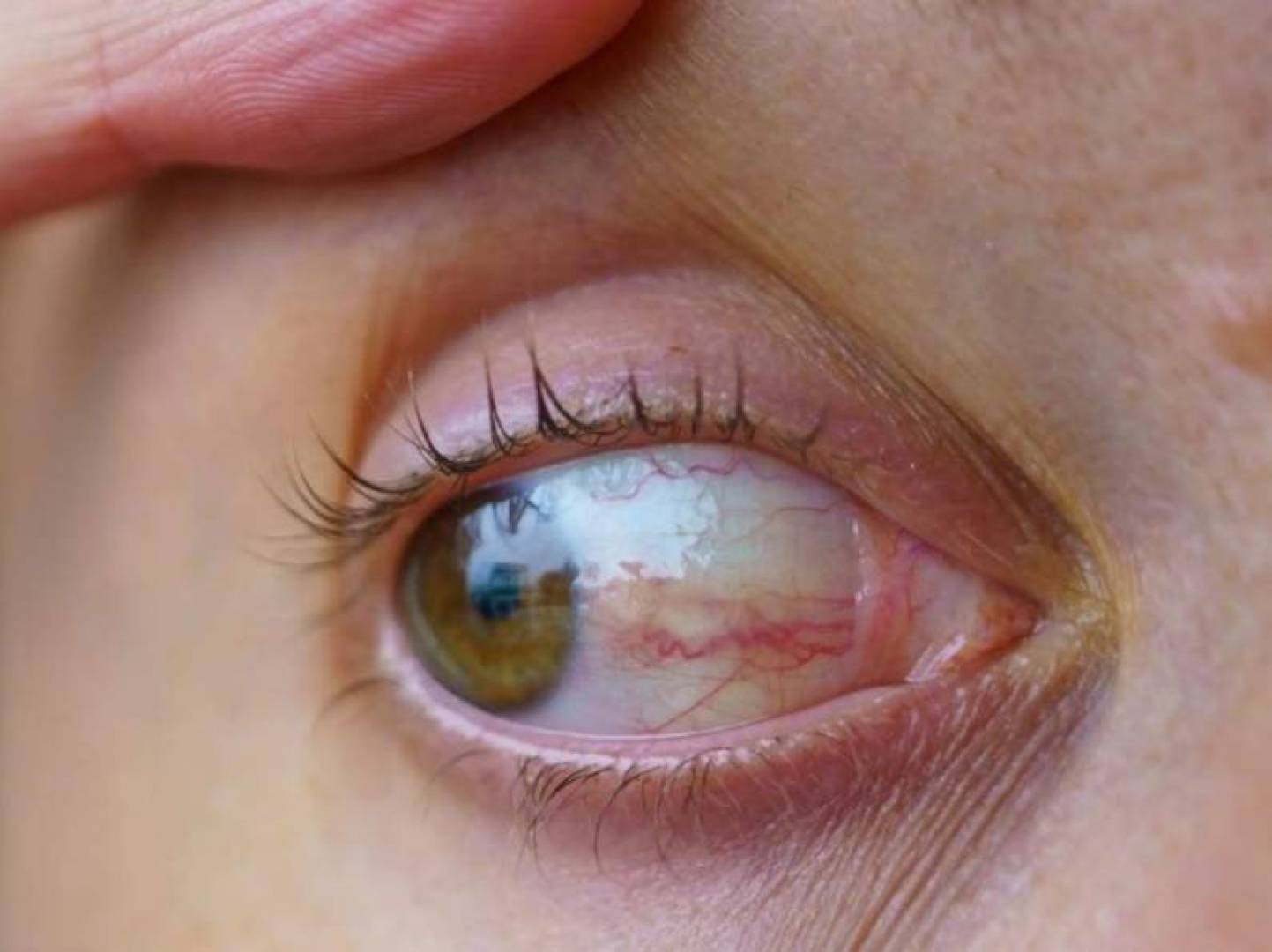 دموع العين تفتح آفاق جديدة لتشخيص أمراض العيون والدماغ