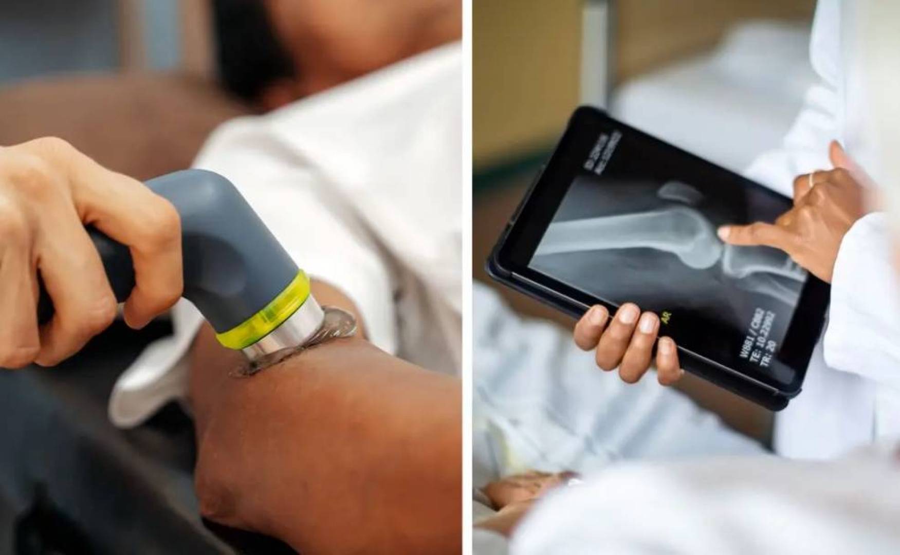 بناء العظام المكسورة بتقنية الطباعة ثلاثية الأبعاد