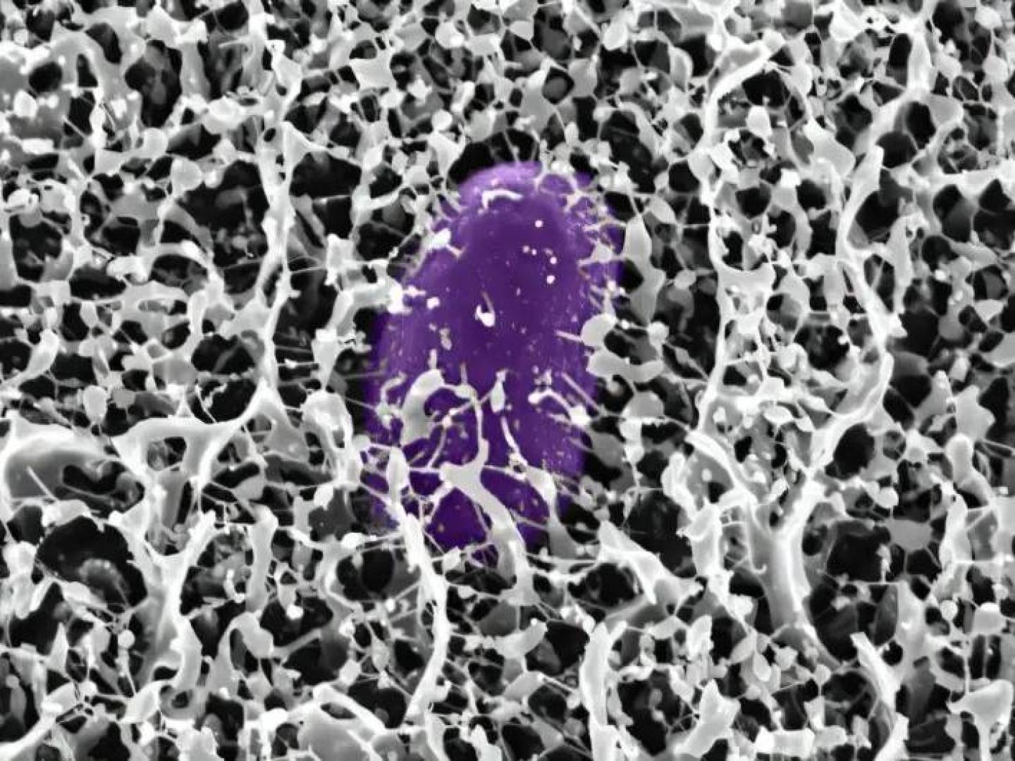 الخلايا البطانية اللمفاوية تساعد المناعة على تذكر العدوى؟ الخلايا البطانية اللمفاوية تساعد المناعة على تذكر العدوى؟