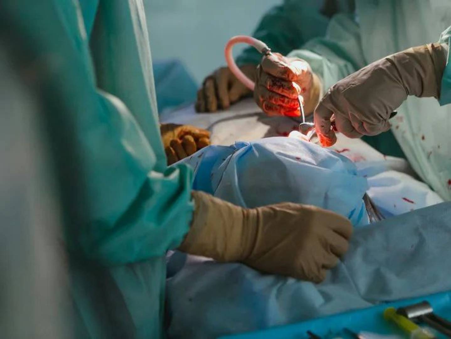 ابتكار روسي يفتح آفاقا جديدة في علاج تلف عضلة القلب