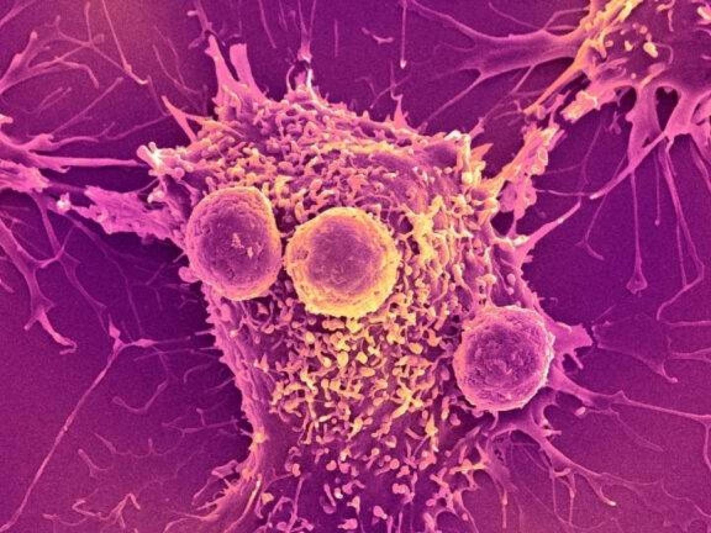 بكتيريا تحارب السرطان ثم تدمير نفسها ذاتيا